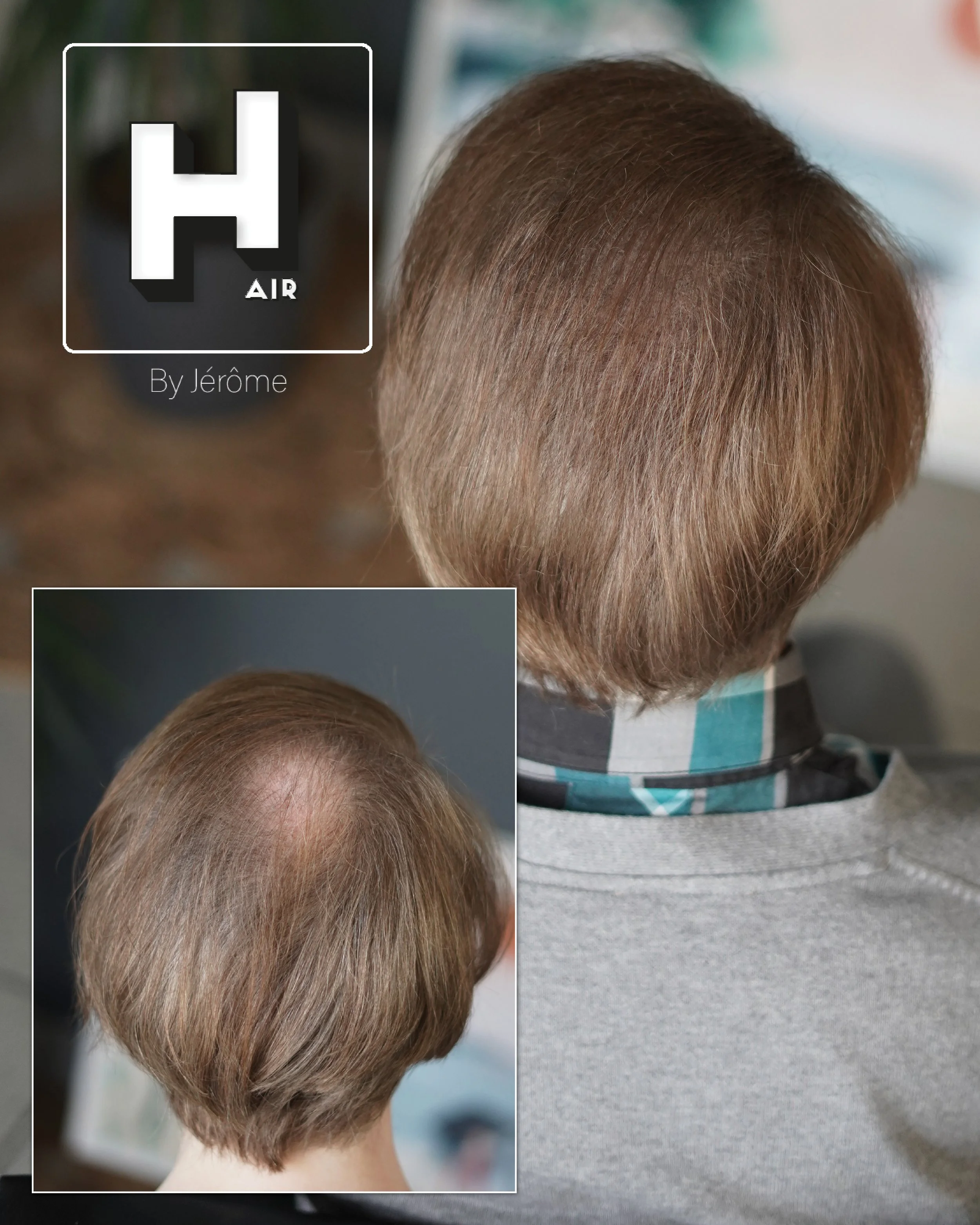 densité cheveux homme micropigmentation belgique.jpg