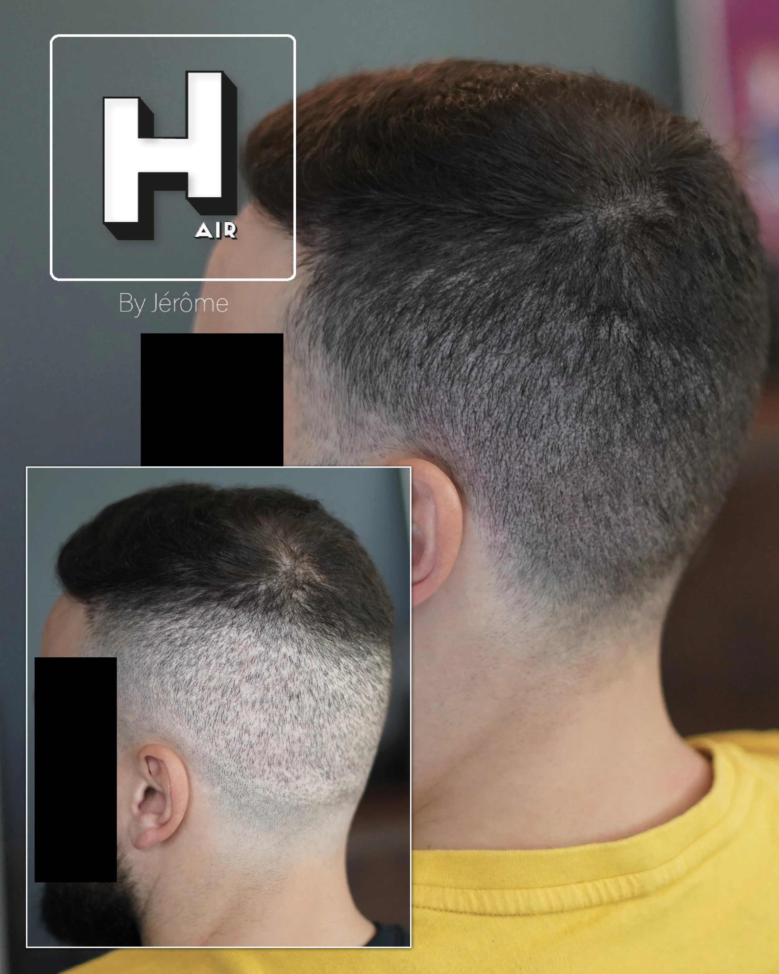 Micropigmentation capillaire en belgique2.jpg