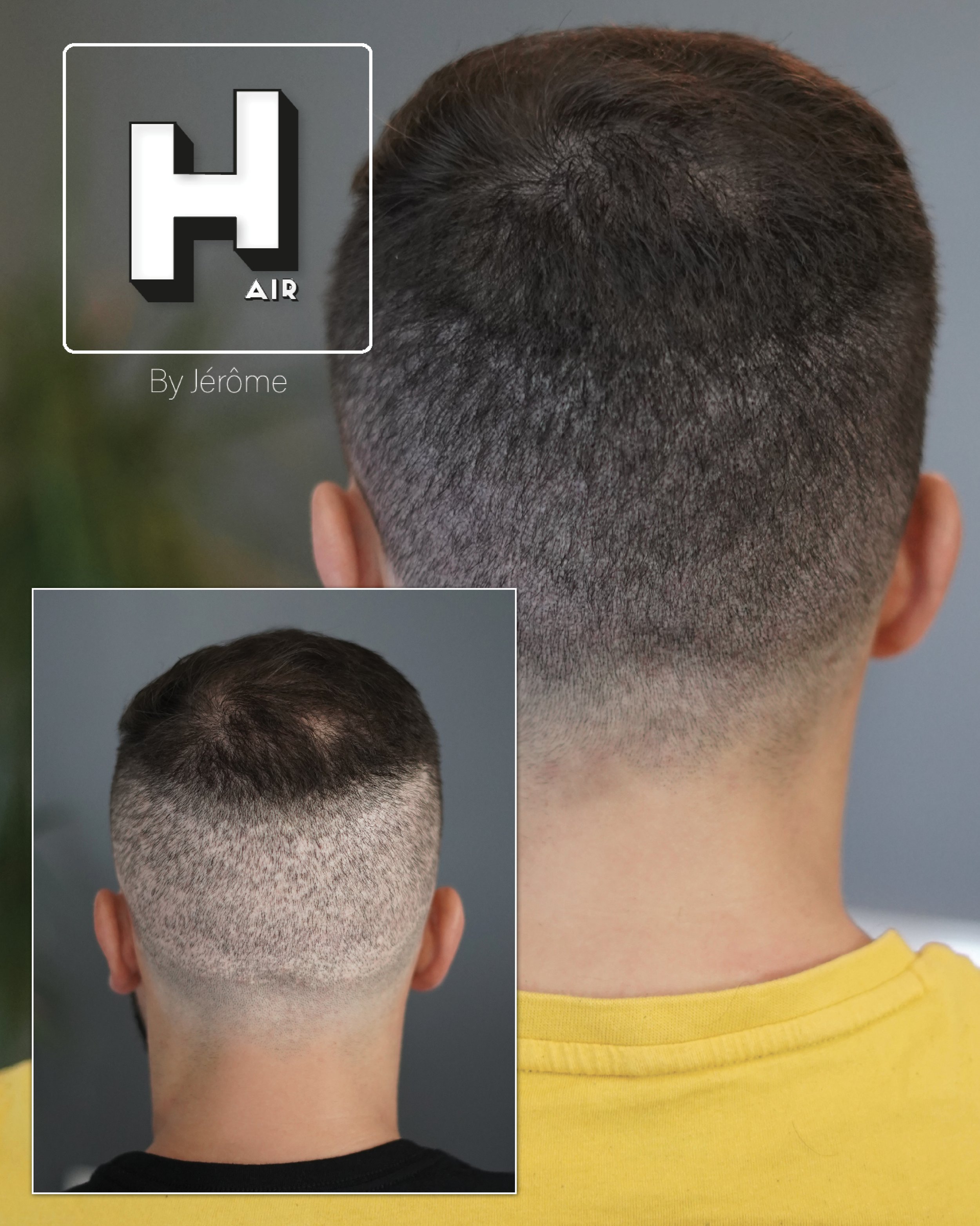 Micropigmentation capillaire en belgique.jpg