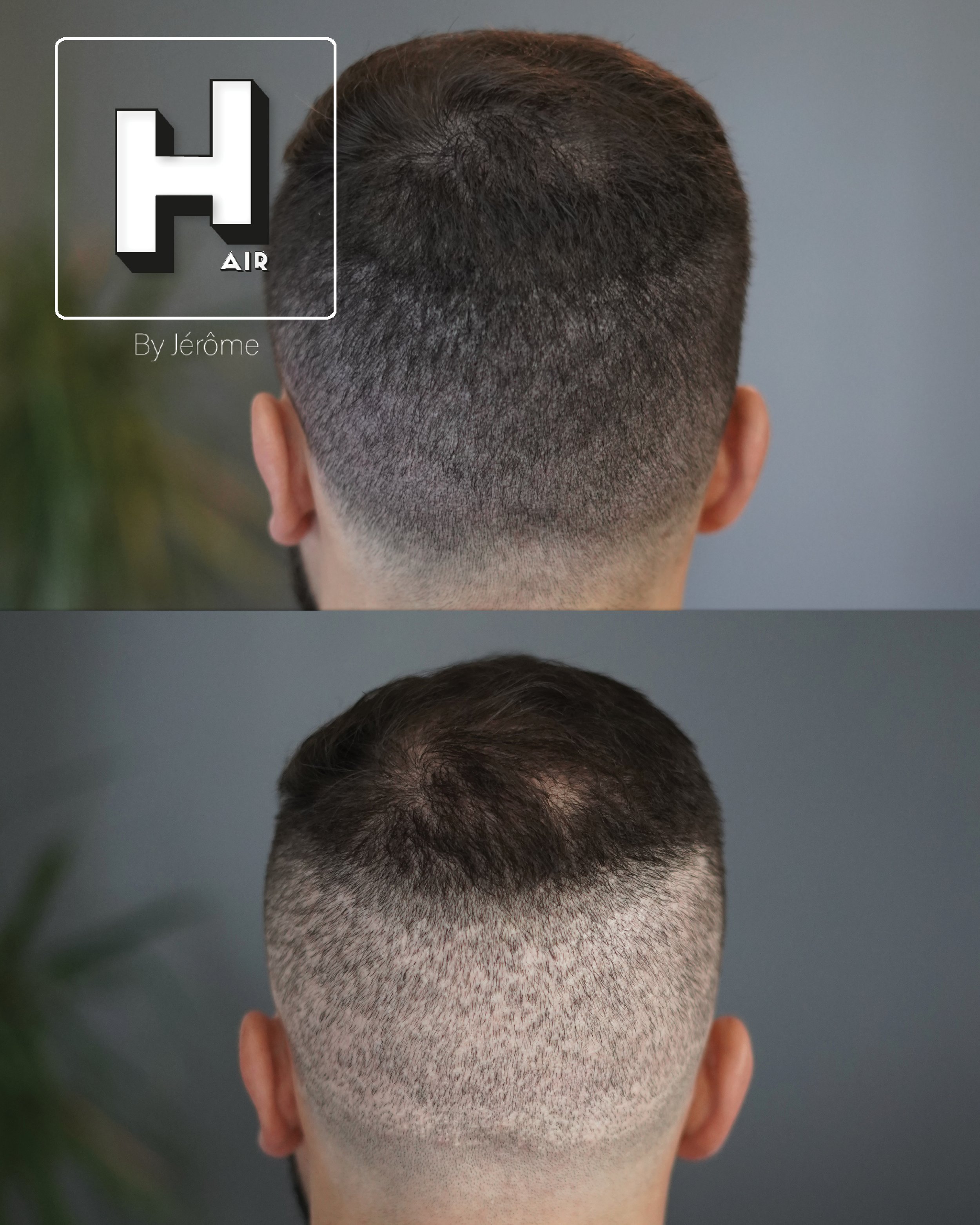 Micropigmentation capillaire en belgique3.jpg