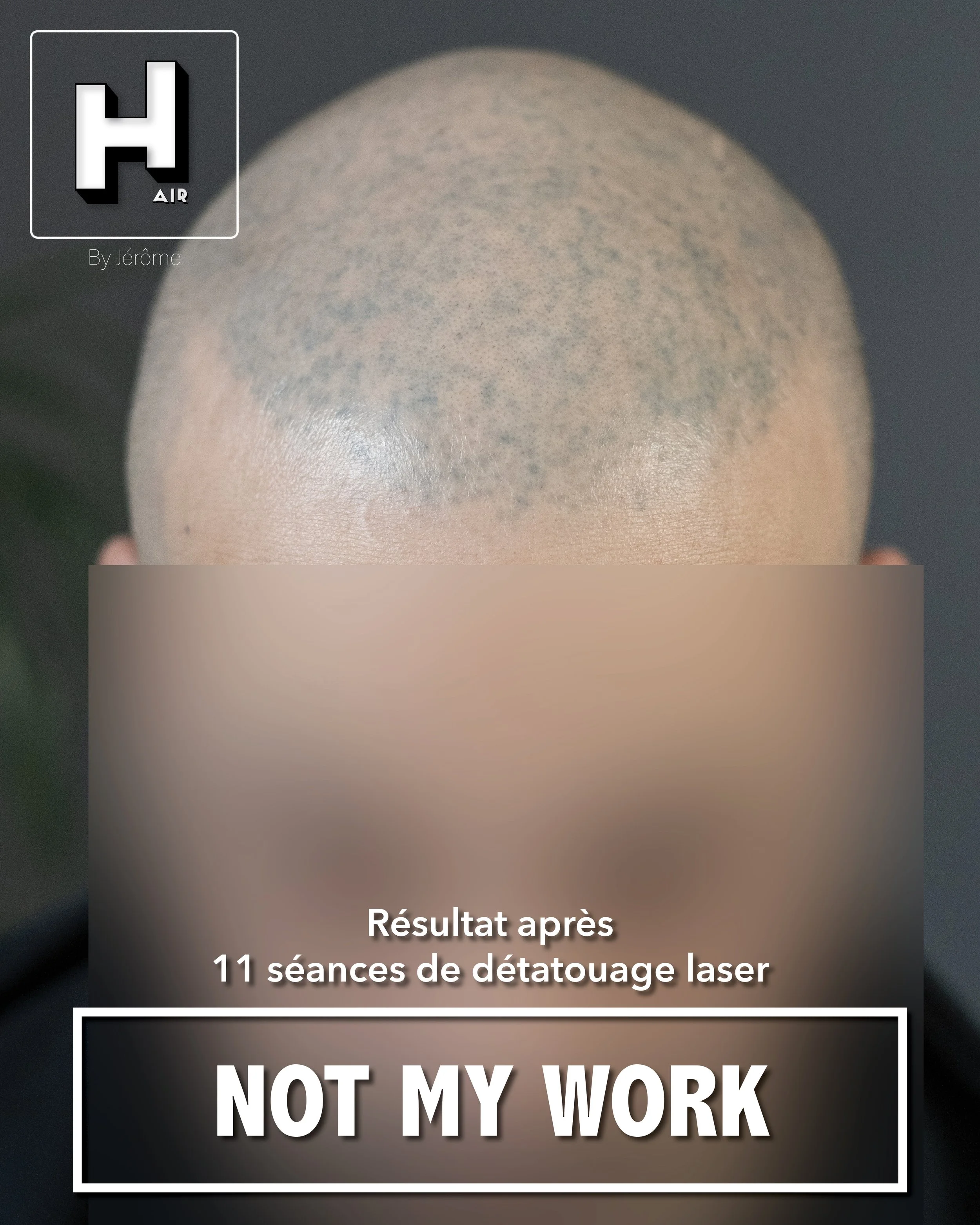 SMP rescue hair by jérôme namur belgique new maha 2.jpg