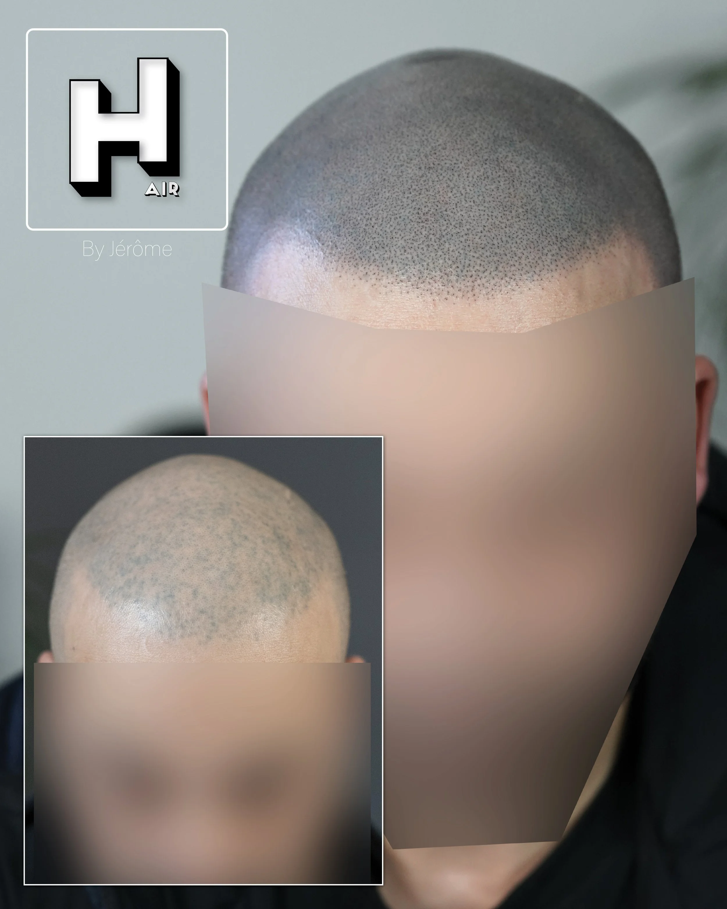 SMP rescue hair by jérôme namur belgique new maha y.jpg