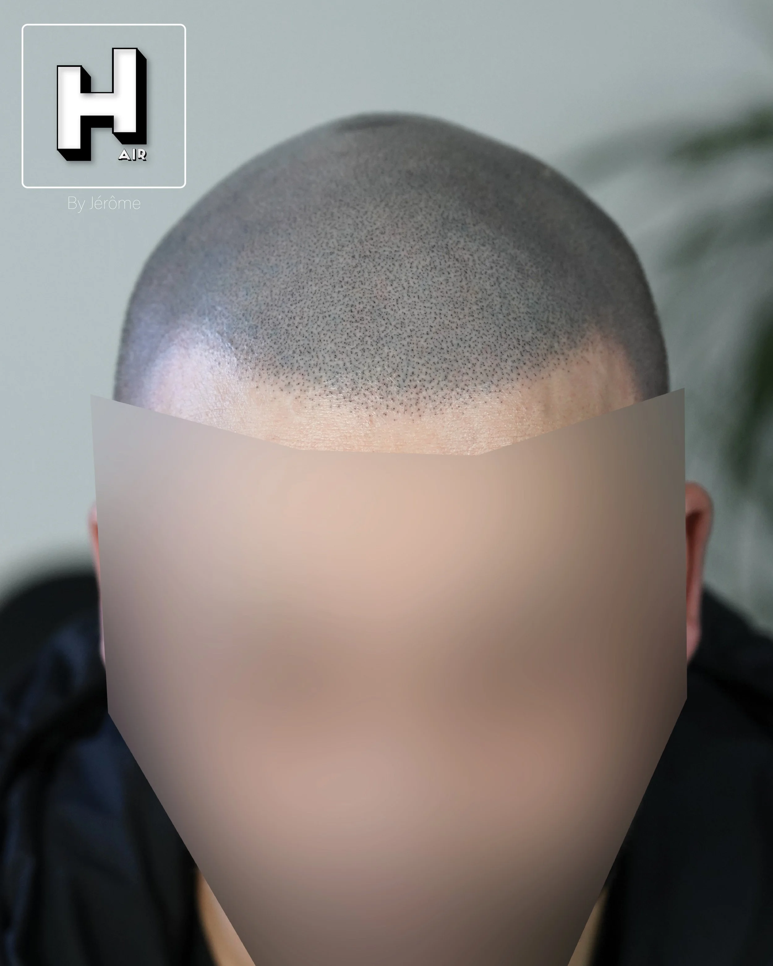 SMP rescue hair by jérôme namur belgique.3.jpg