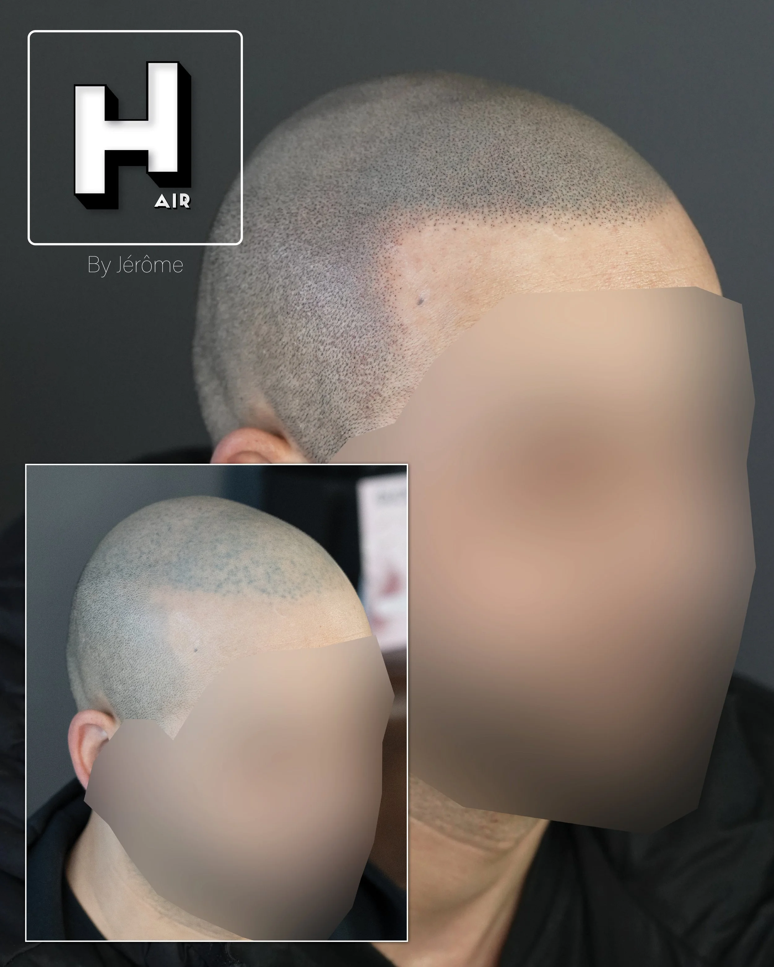 SMP rescue hair by jérôme namur belgique.5.jpg