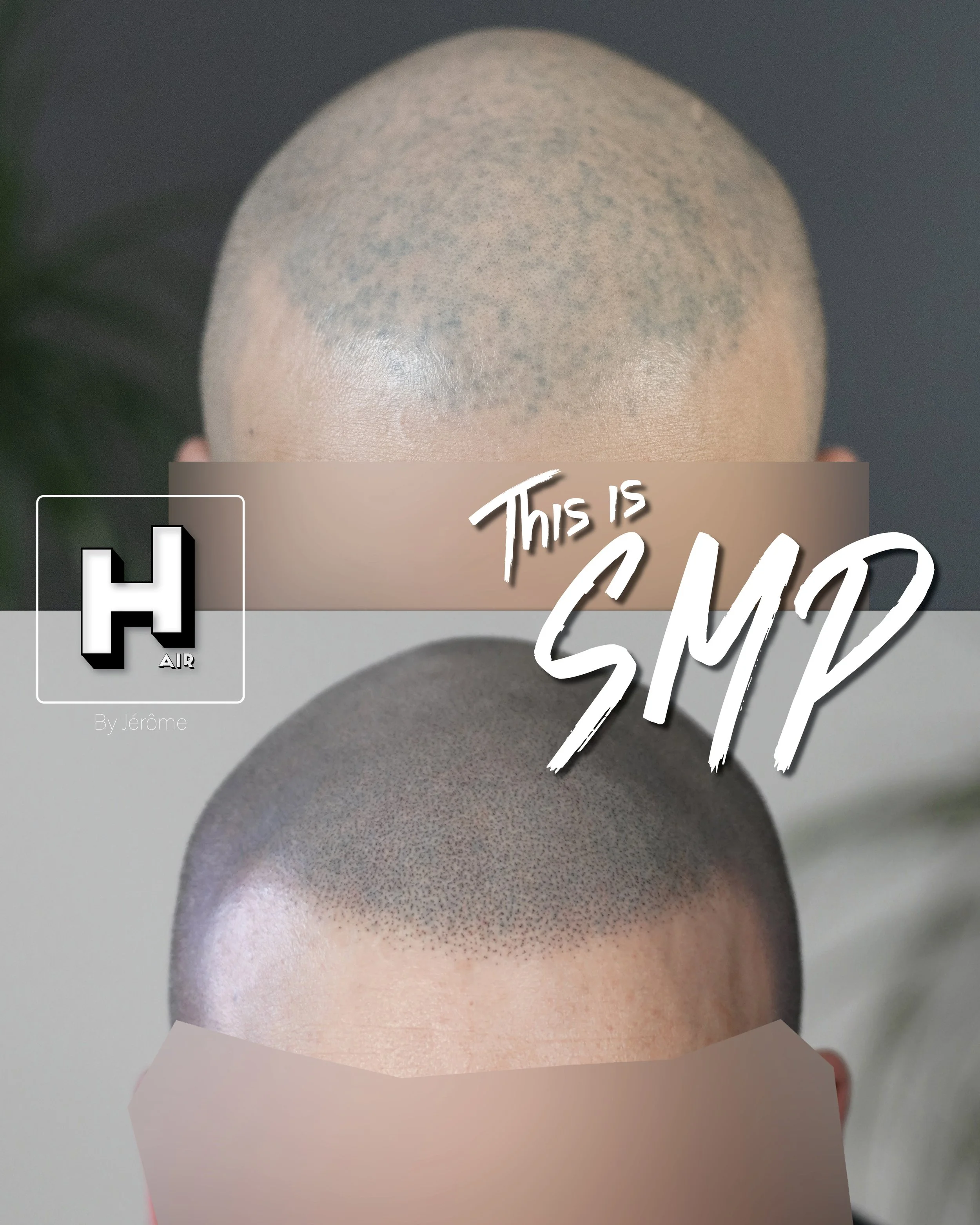 SMP rescue hair by jérôme namur belgique.4.jpg