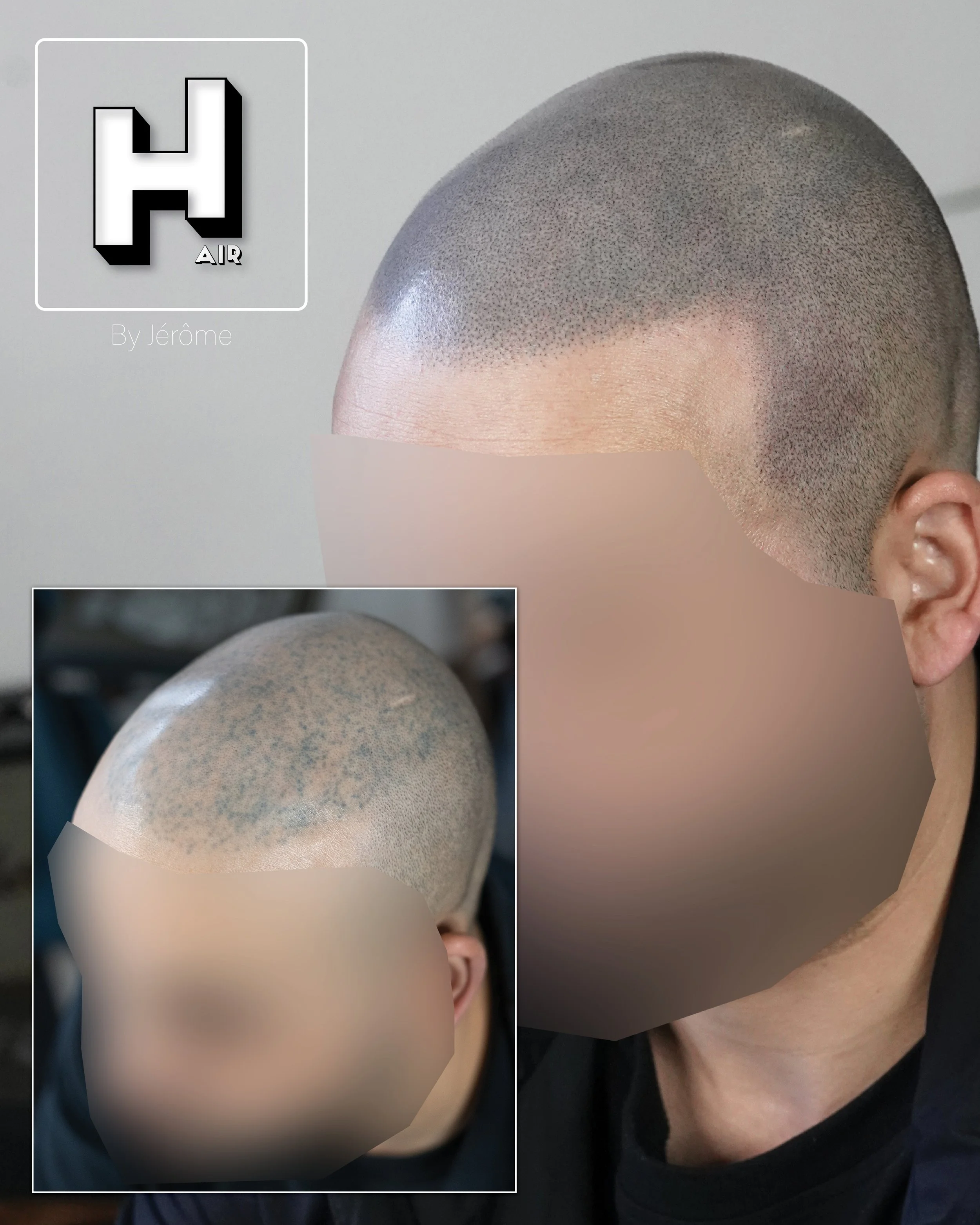 SMP rescue hair by jérôme namur belgique.6.jpg