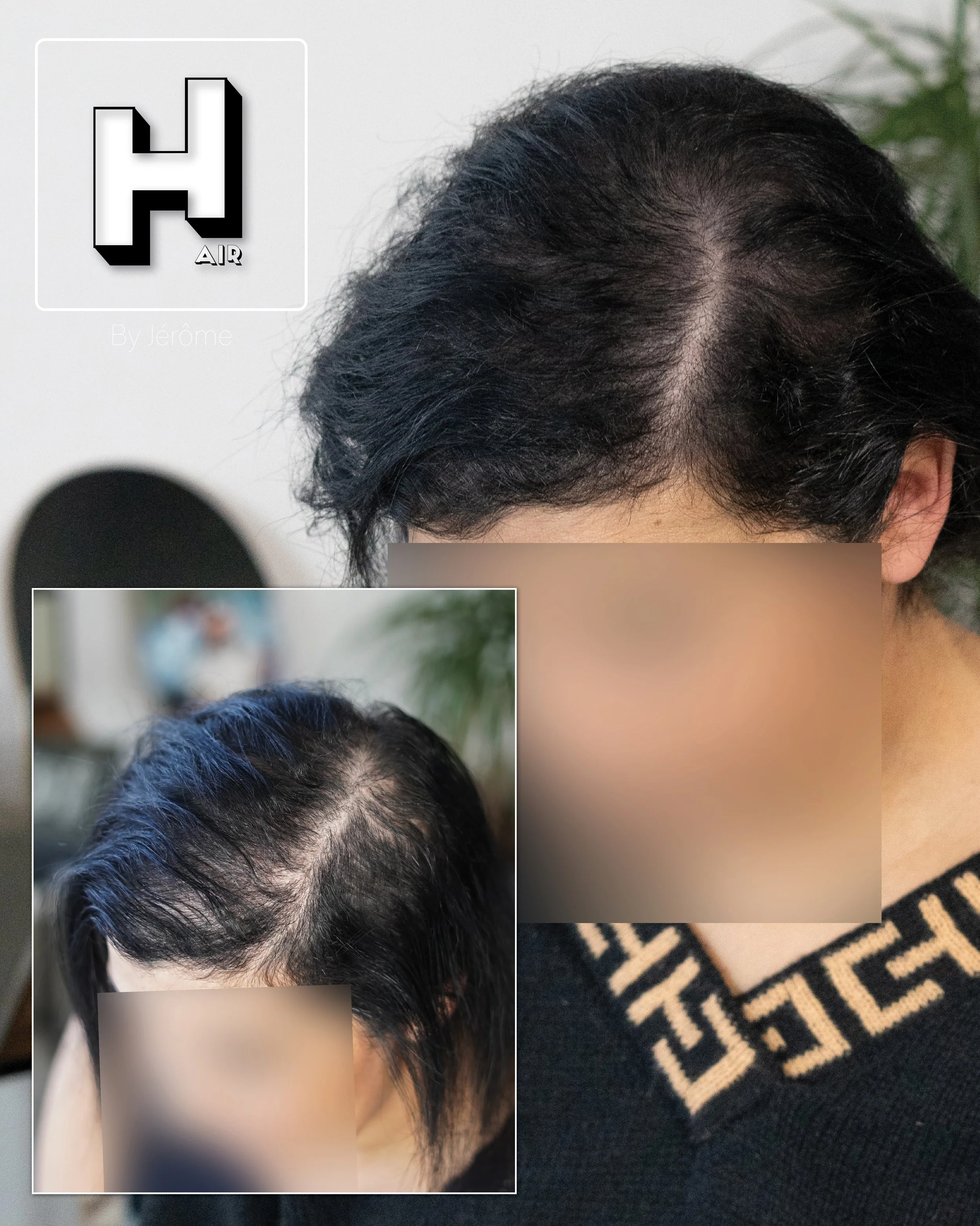 densité hair by jerome smpbelgium smpartistbelgium micropigmentationbelgium2.jpg