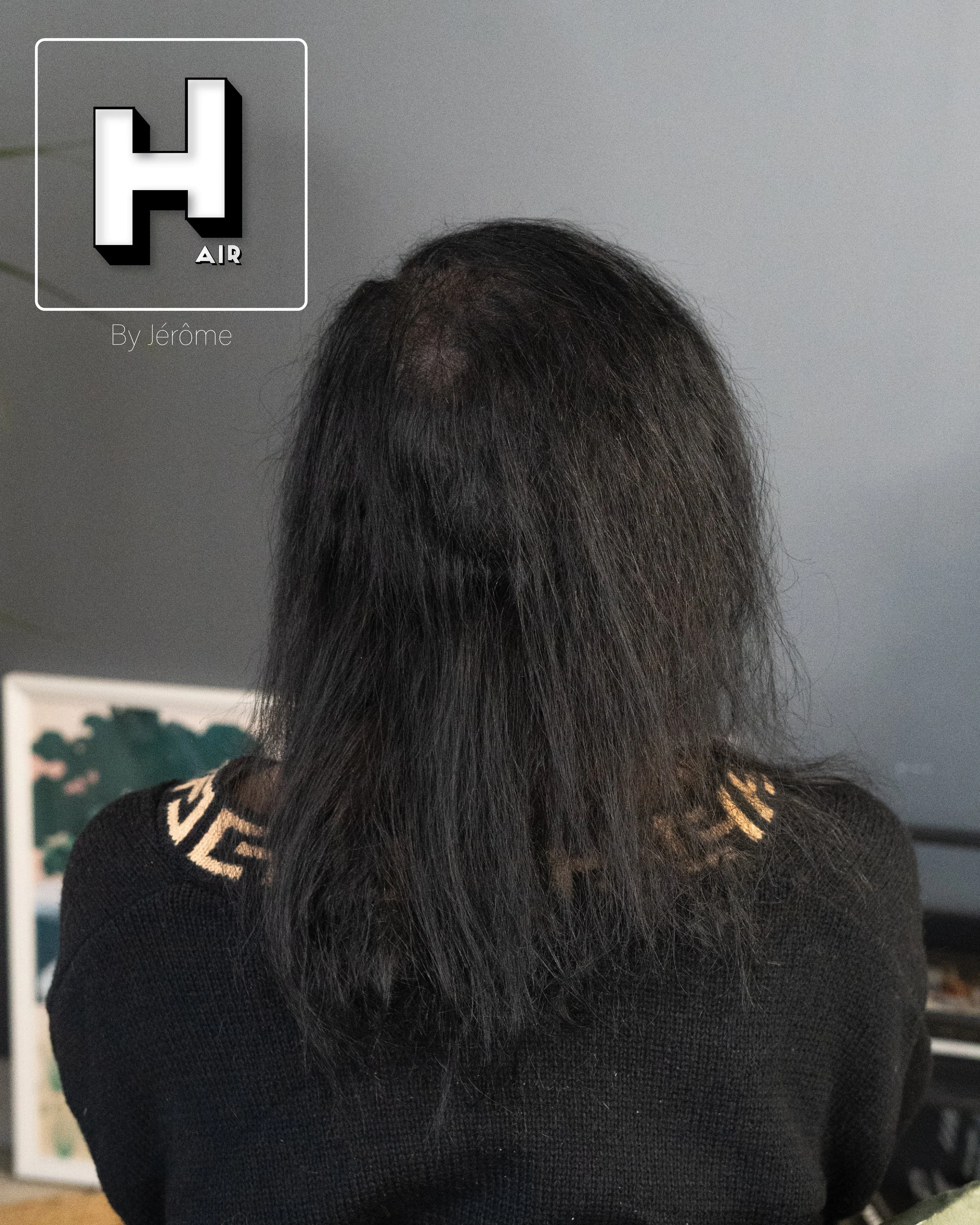 densité hair by jerome smpbelgium smpartistbelgium micropigmentationbelgium7.jpg