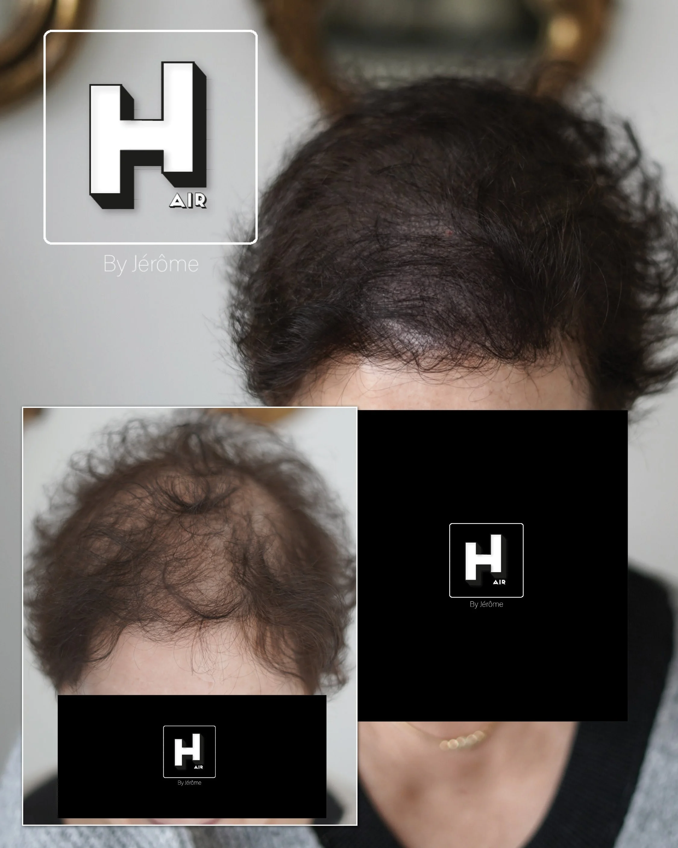 micropigmentation capillaire hair by jerome.jpg