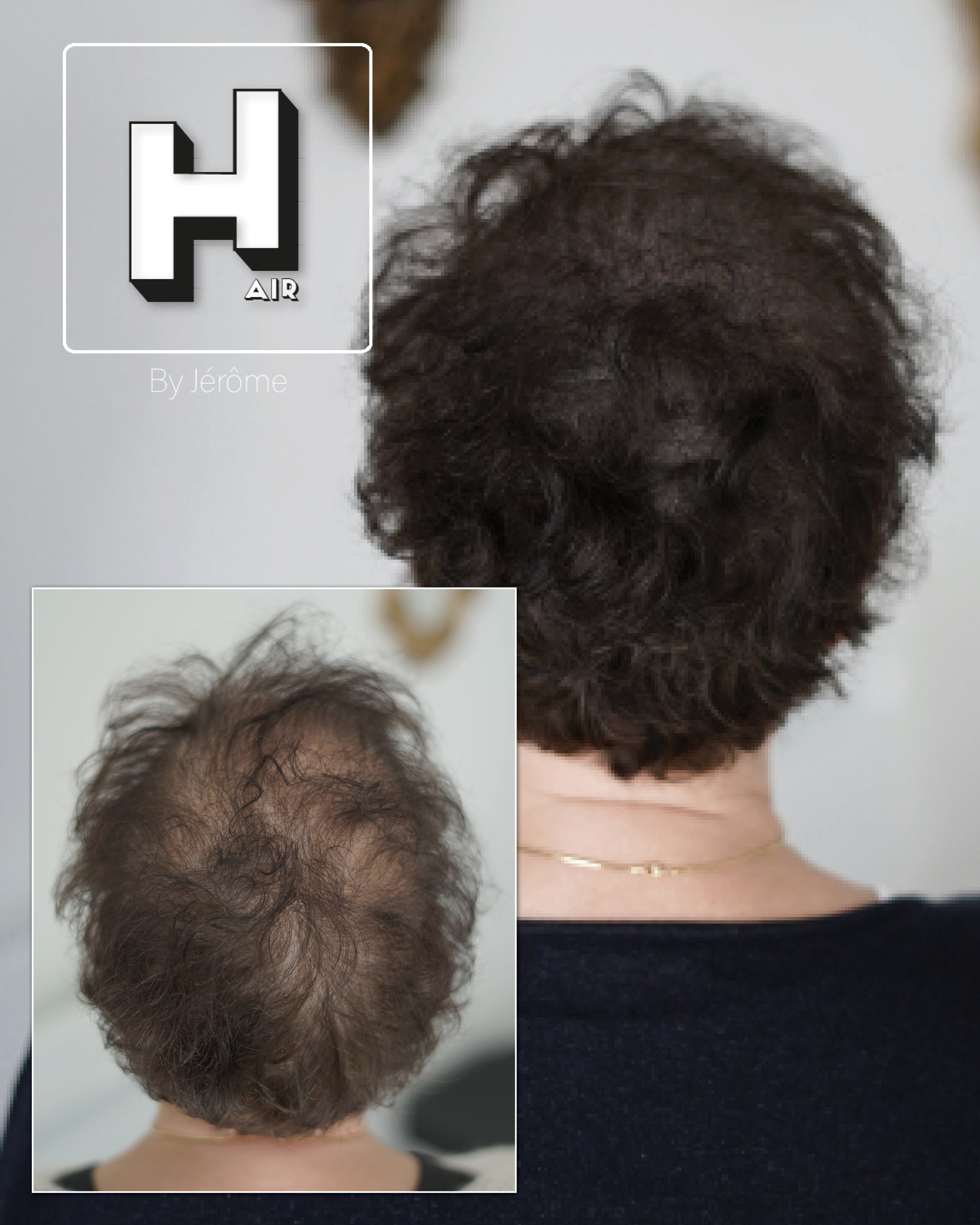 micropigmentation capillaire hair by jerome3.jpg