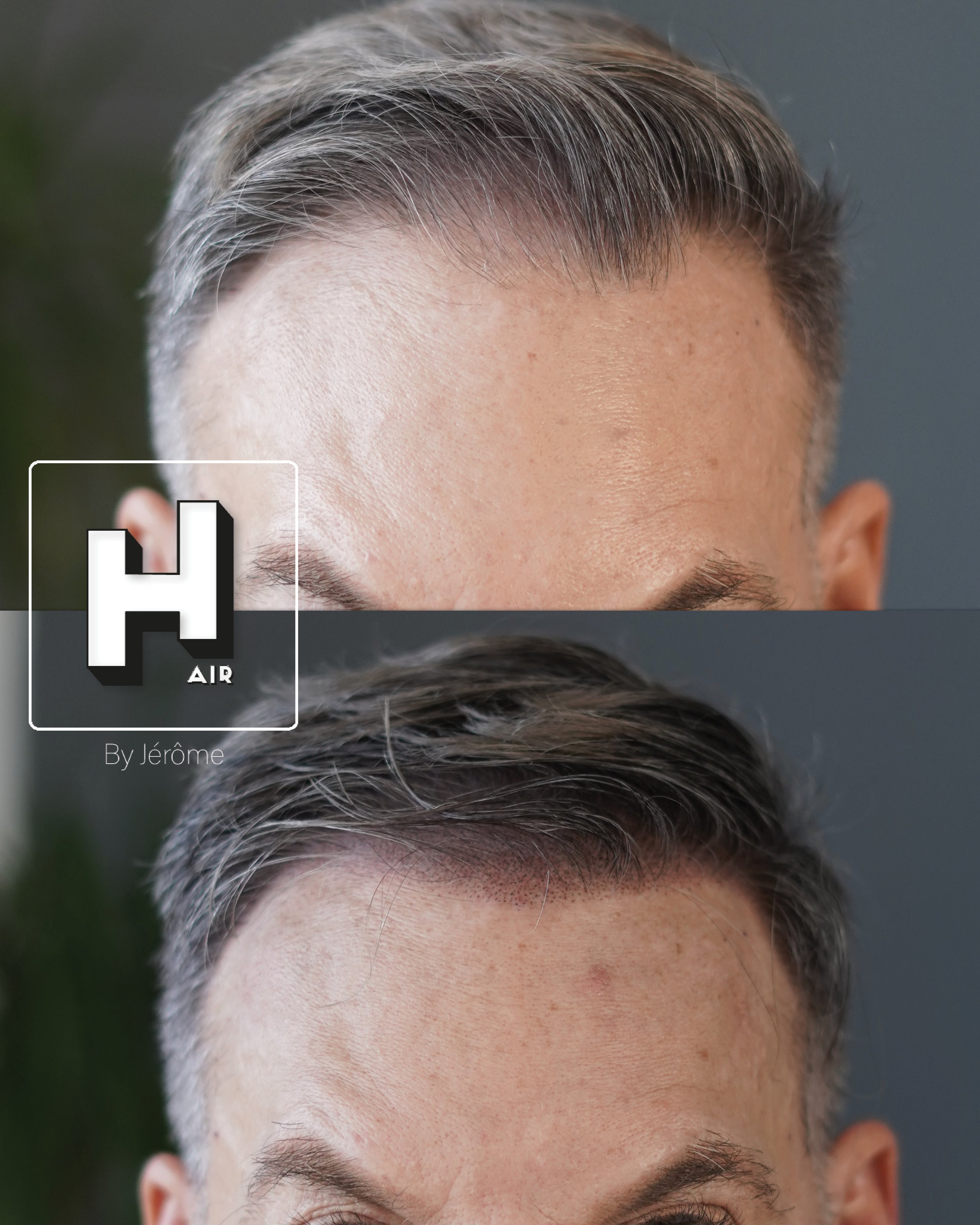 Densité ligne frontale hair by jérome.jpg