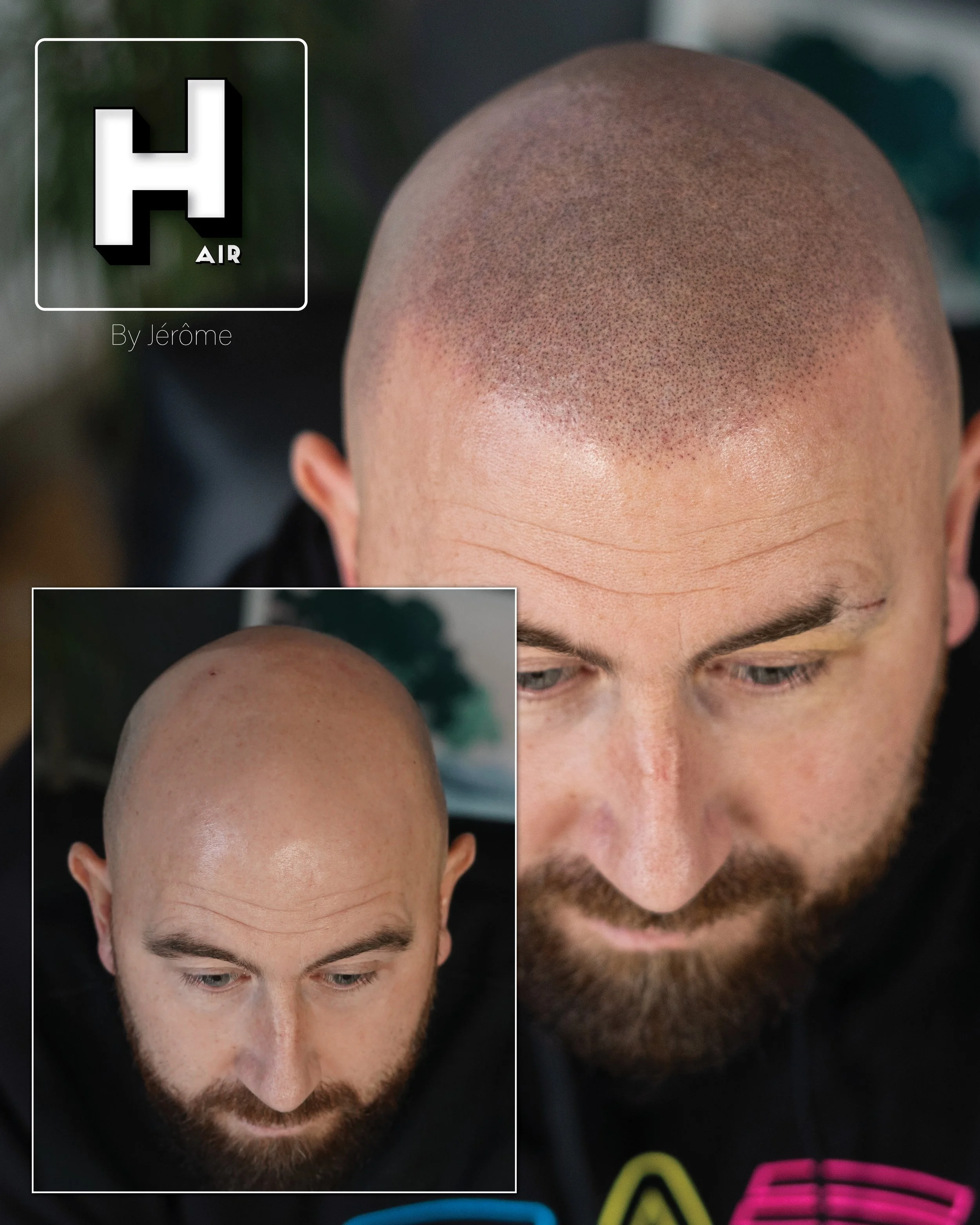 effet rasé micropigmentation namur.jpg