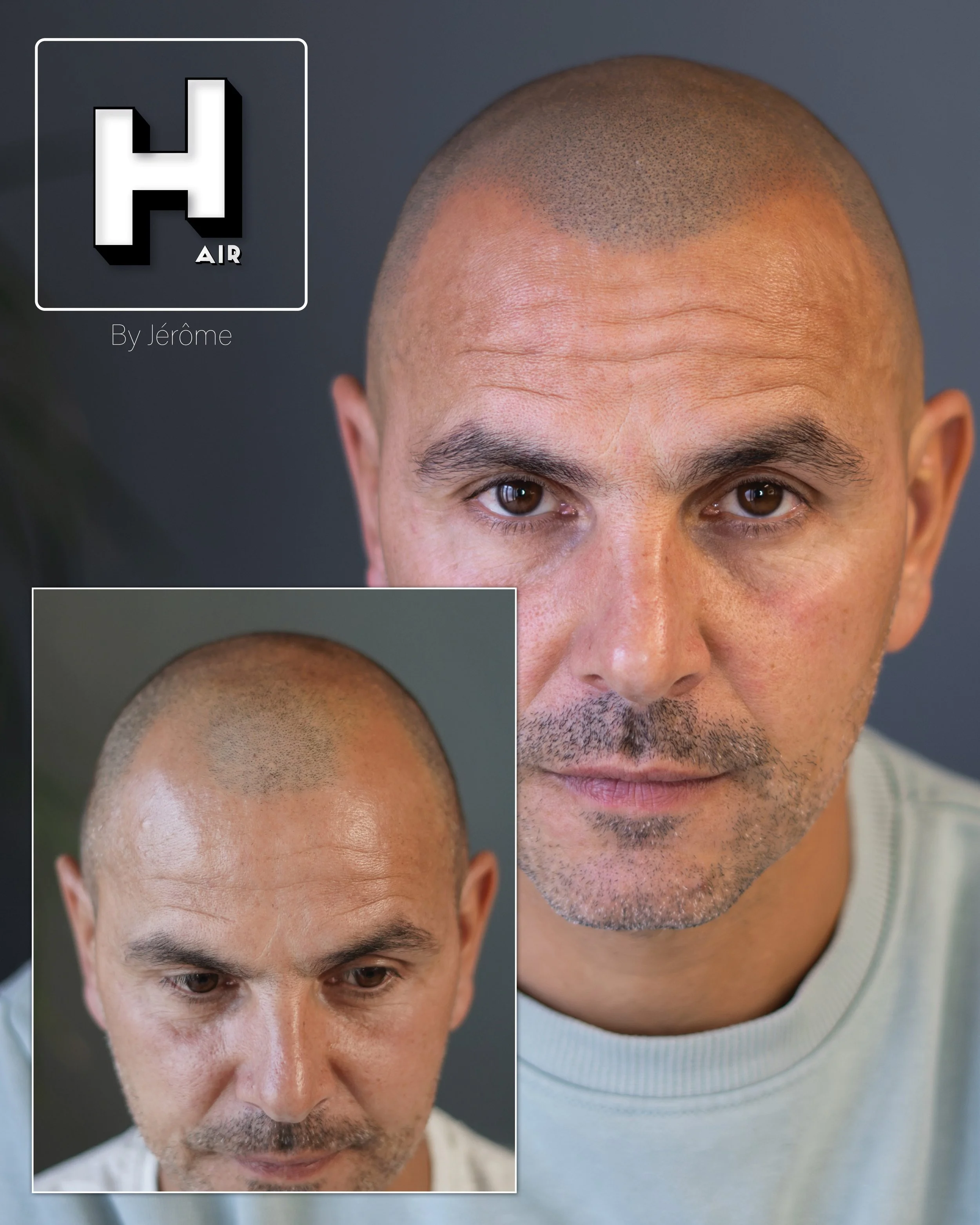 effet rasé pour perte de cheveux belgique.jpg