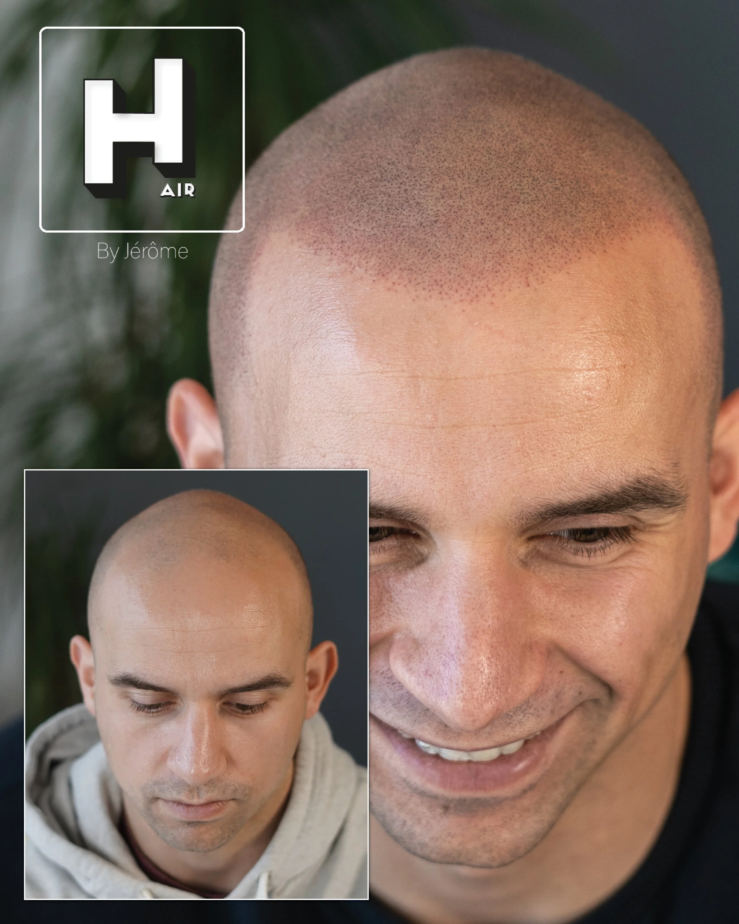 hair by jerome effet rasé true folicle5.jpg