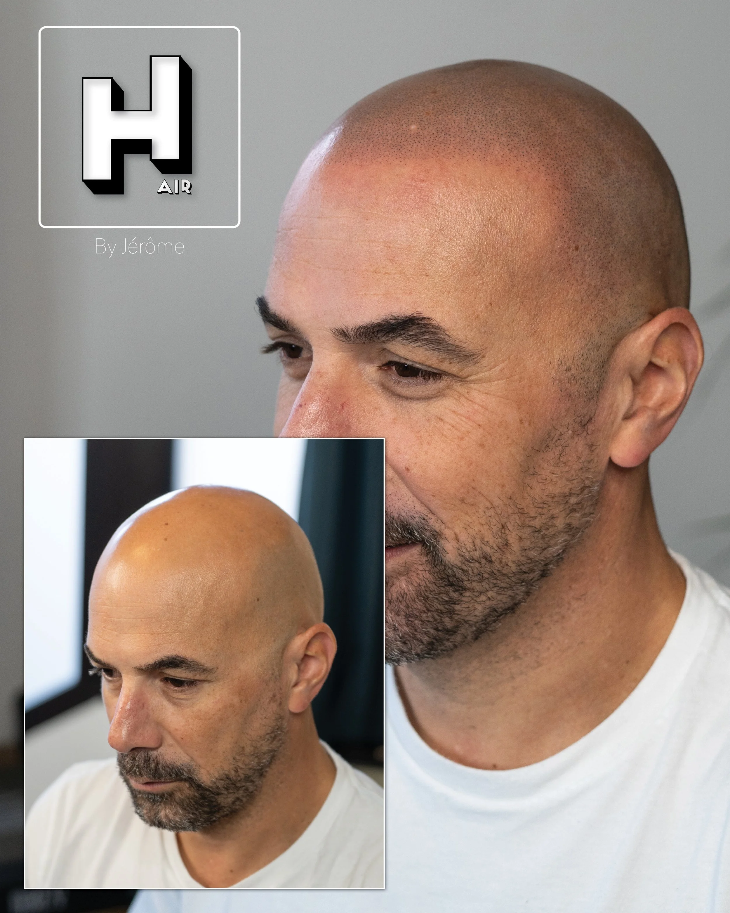 natural smp hair by jerome micropigmentation capillaire effet naturel belgique5.jpg