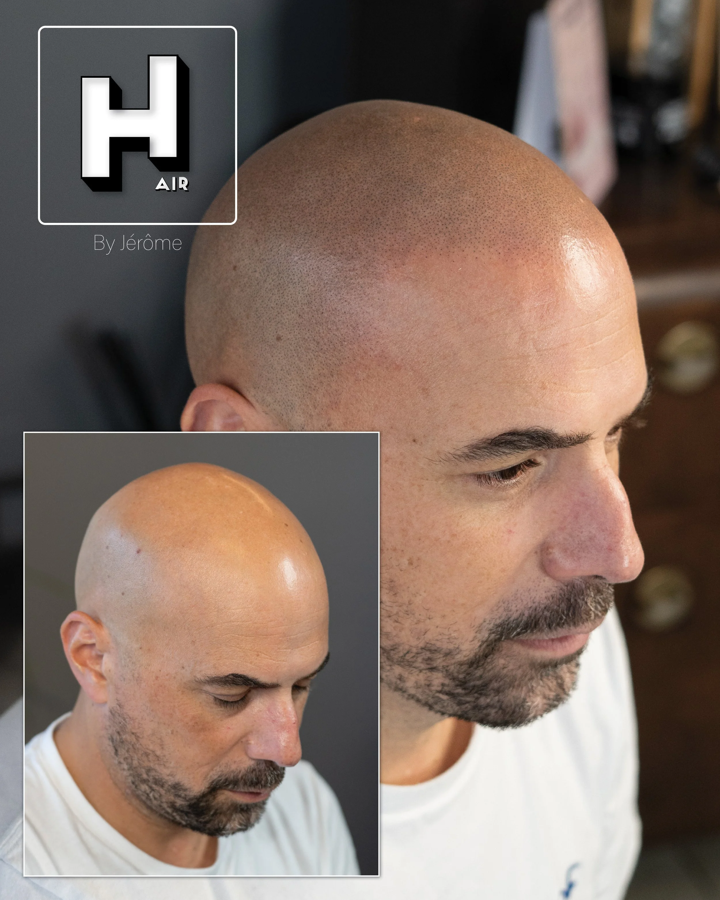 natural smp hair by jerome micropigmentation capillaire effet naturel belgique7.jpg