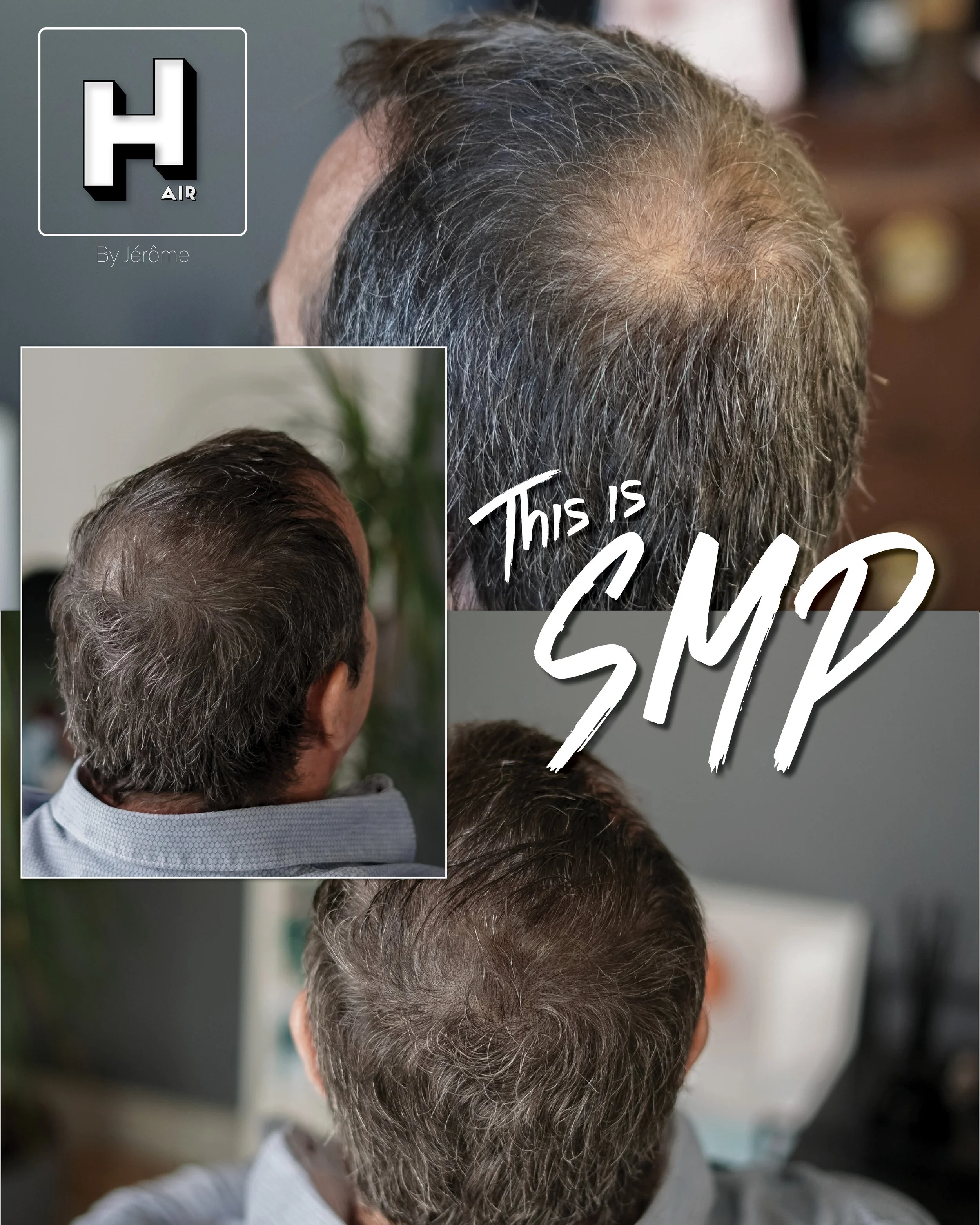 smp hair by jerome micropigmentation capillaire namur et liege3.jpg