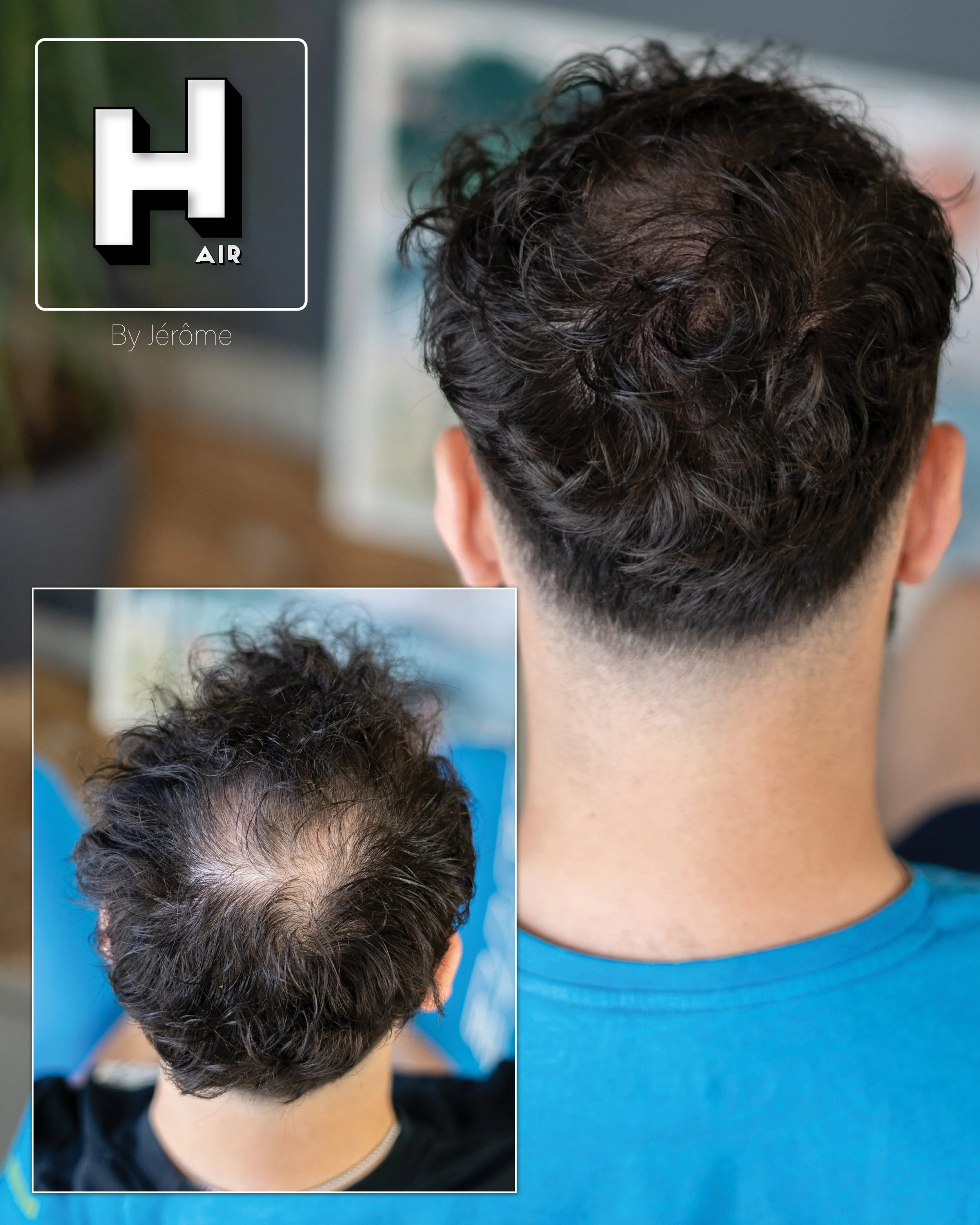 smp hair by jerome micropigmentation capillaire namur et liege5.jpg