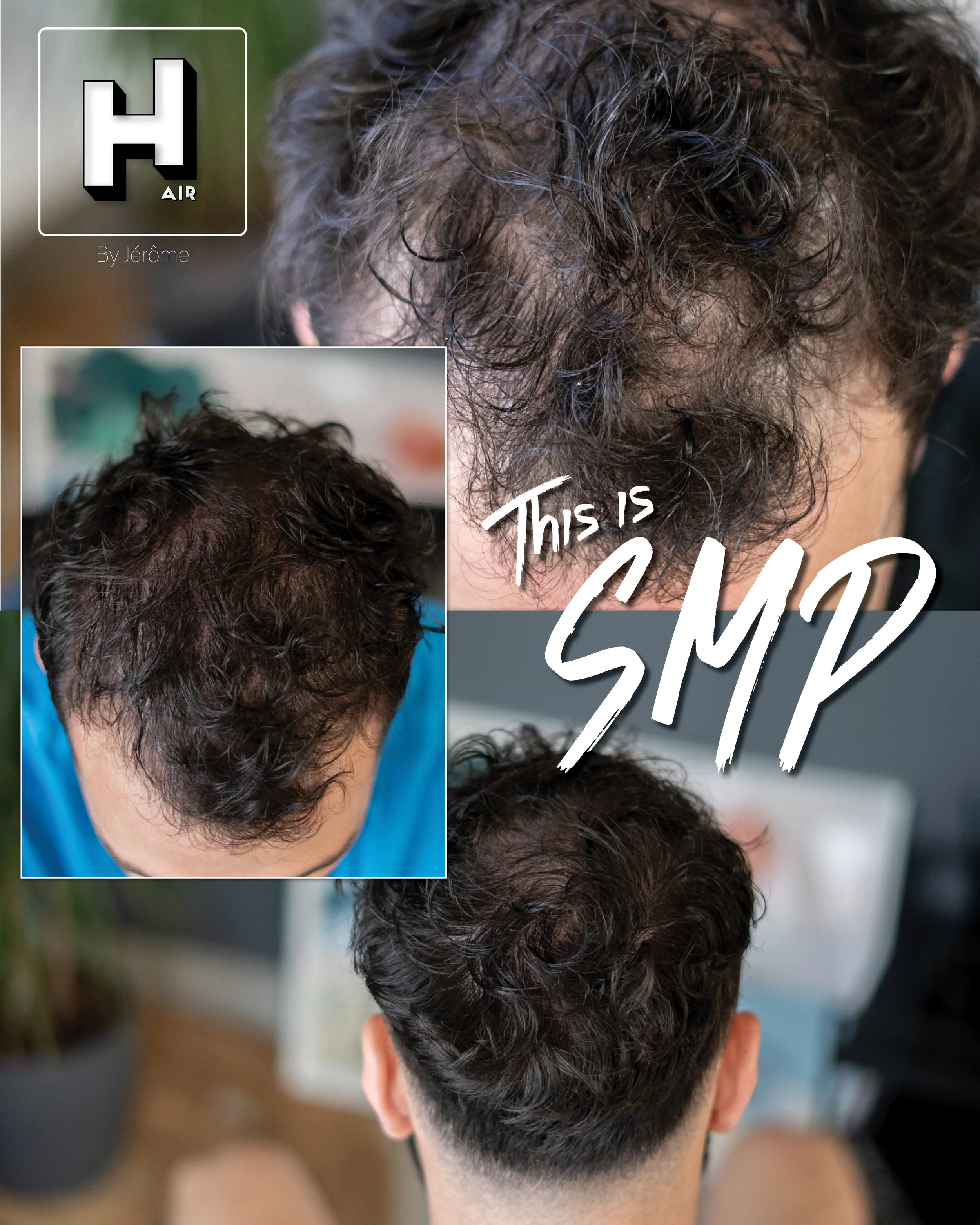smp hair by jerome micropigmentation capillaire namur et liege6.jpg