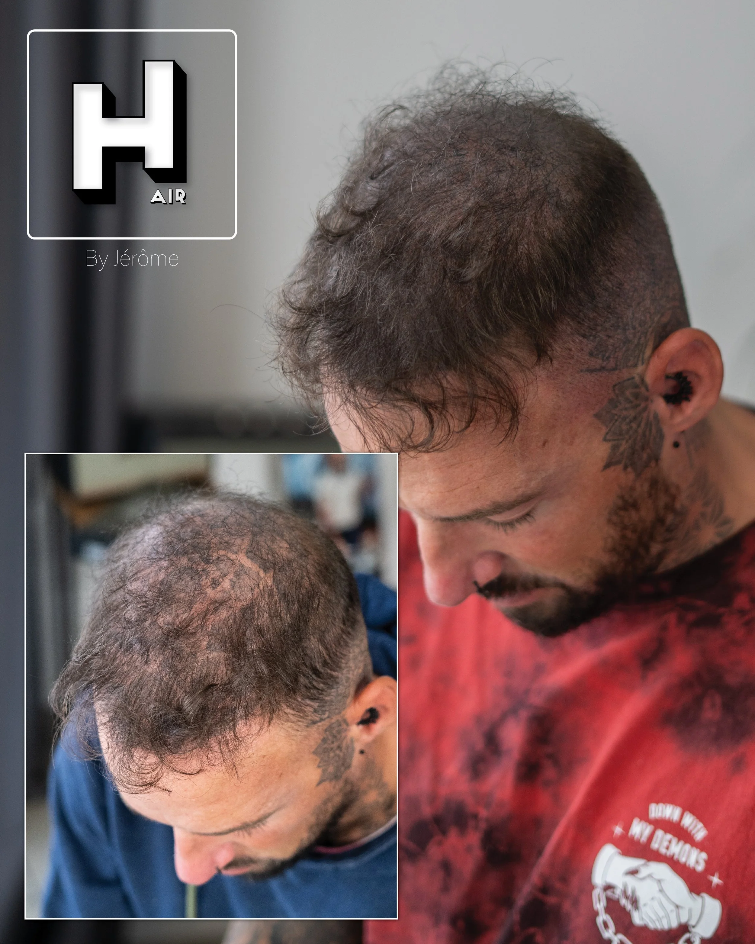 hair by jerome micropigmentation capillaire namur et belgique et luxembourg2.jpg