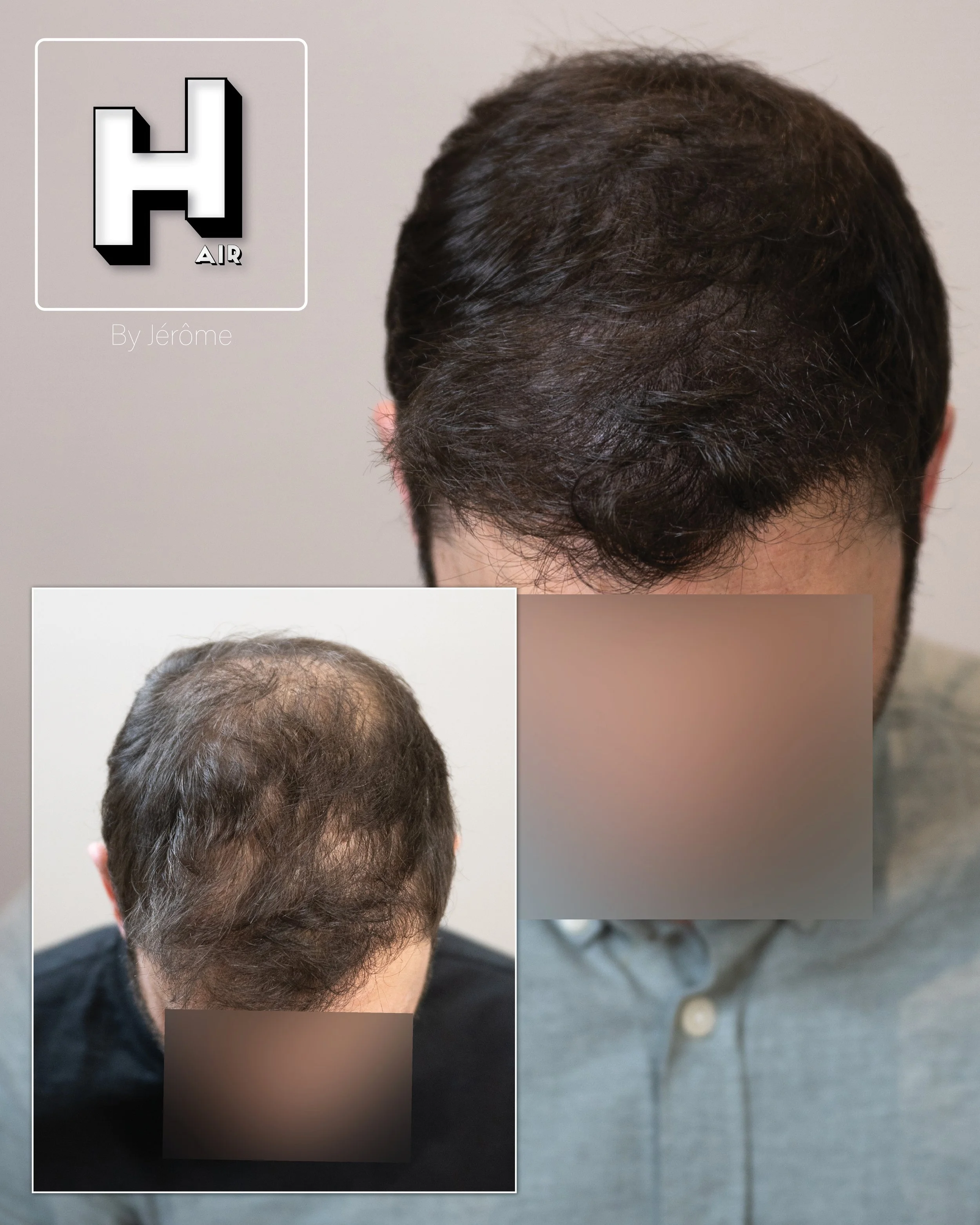 hair by jerome micropigmentation capillaire namur et belgique et luxembourg10.jpg