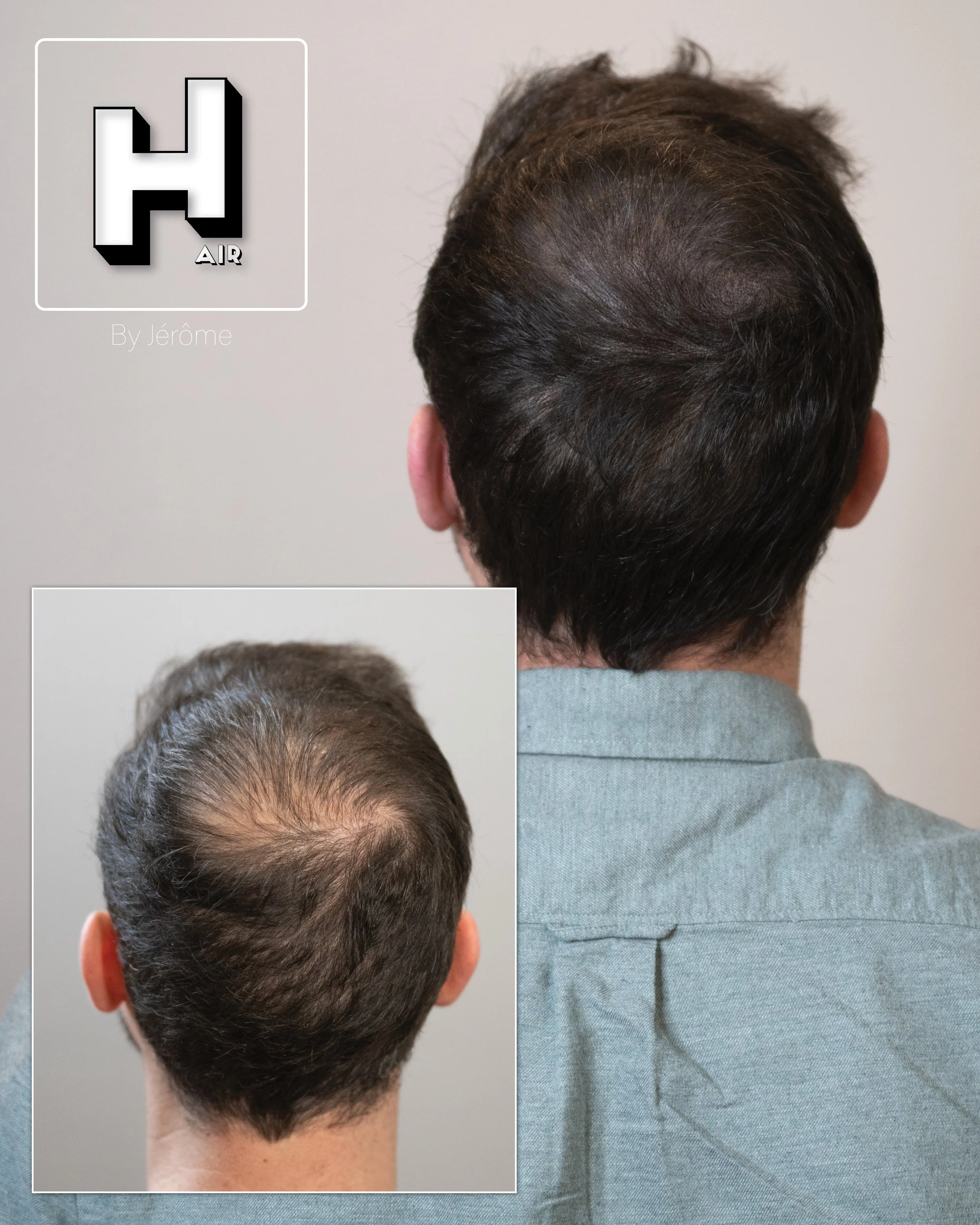 hair by jerome micropigmentation capillaire namur et belgique et luxembourg12.jpg