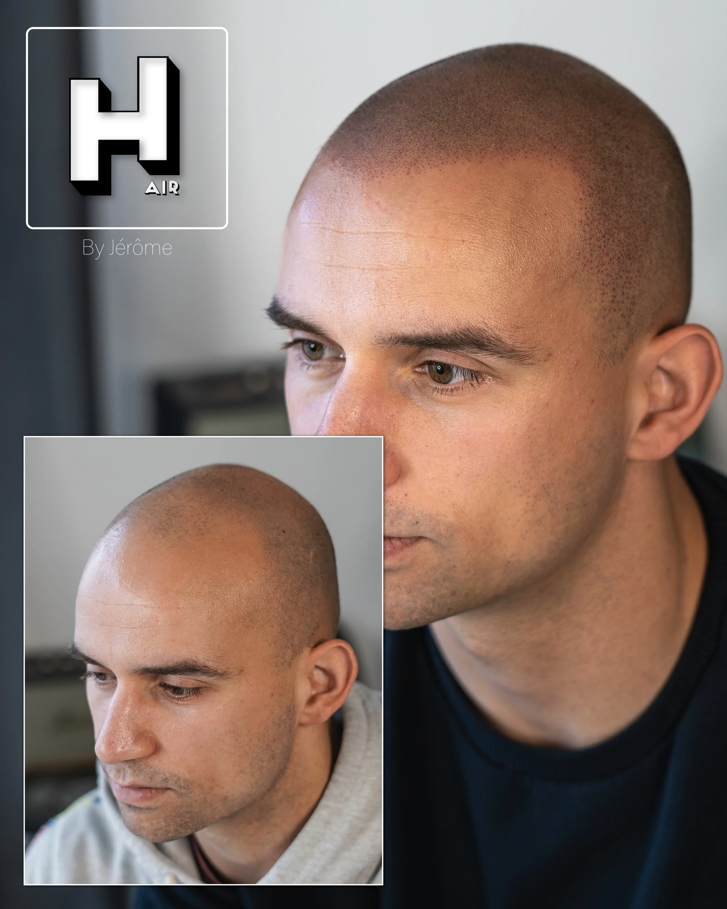 effet rasé micropigmentation namur2.jpg