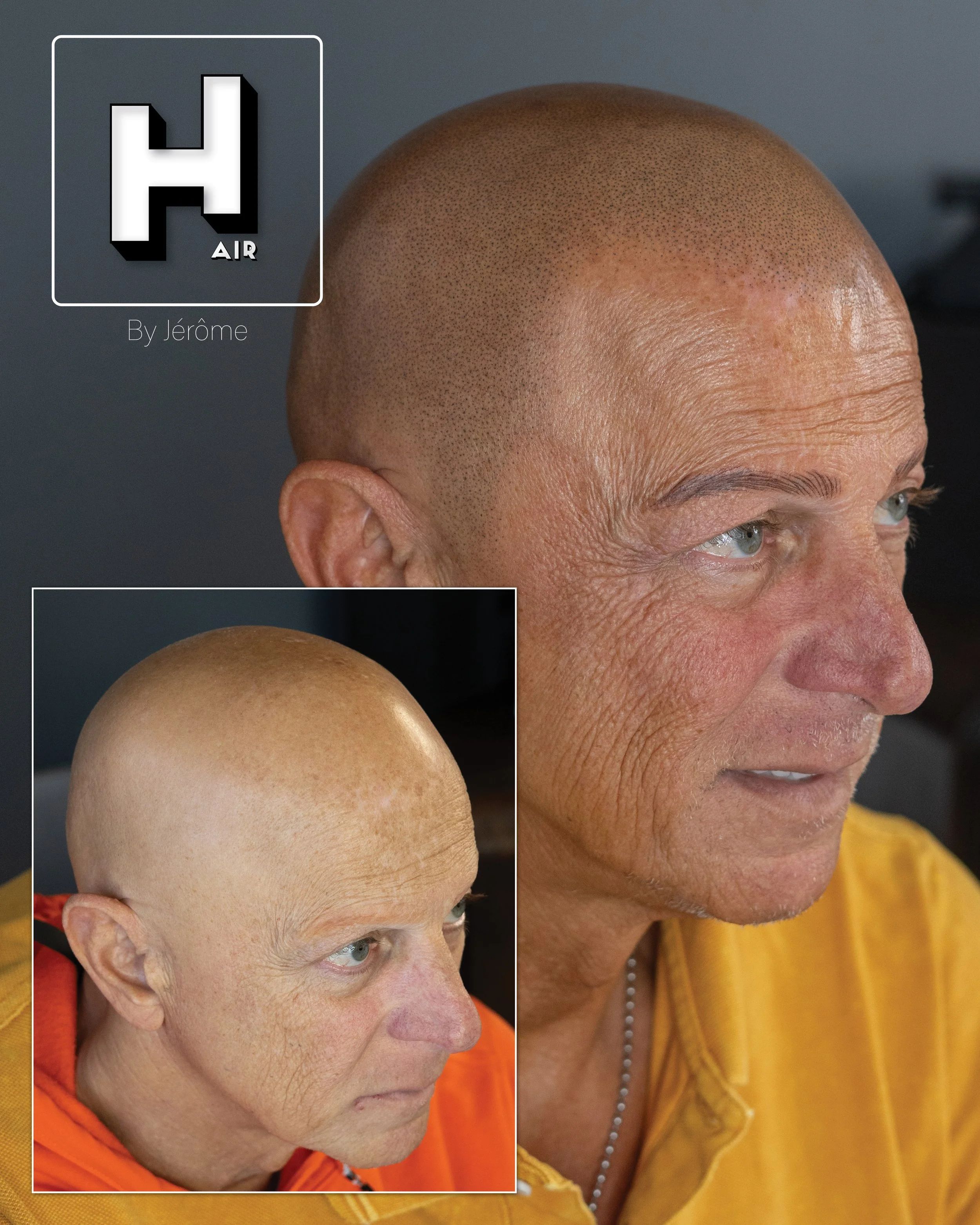 alopecie  universelle hair by jerome smp5.jpg