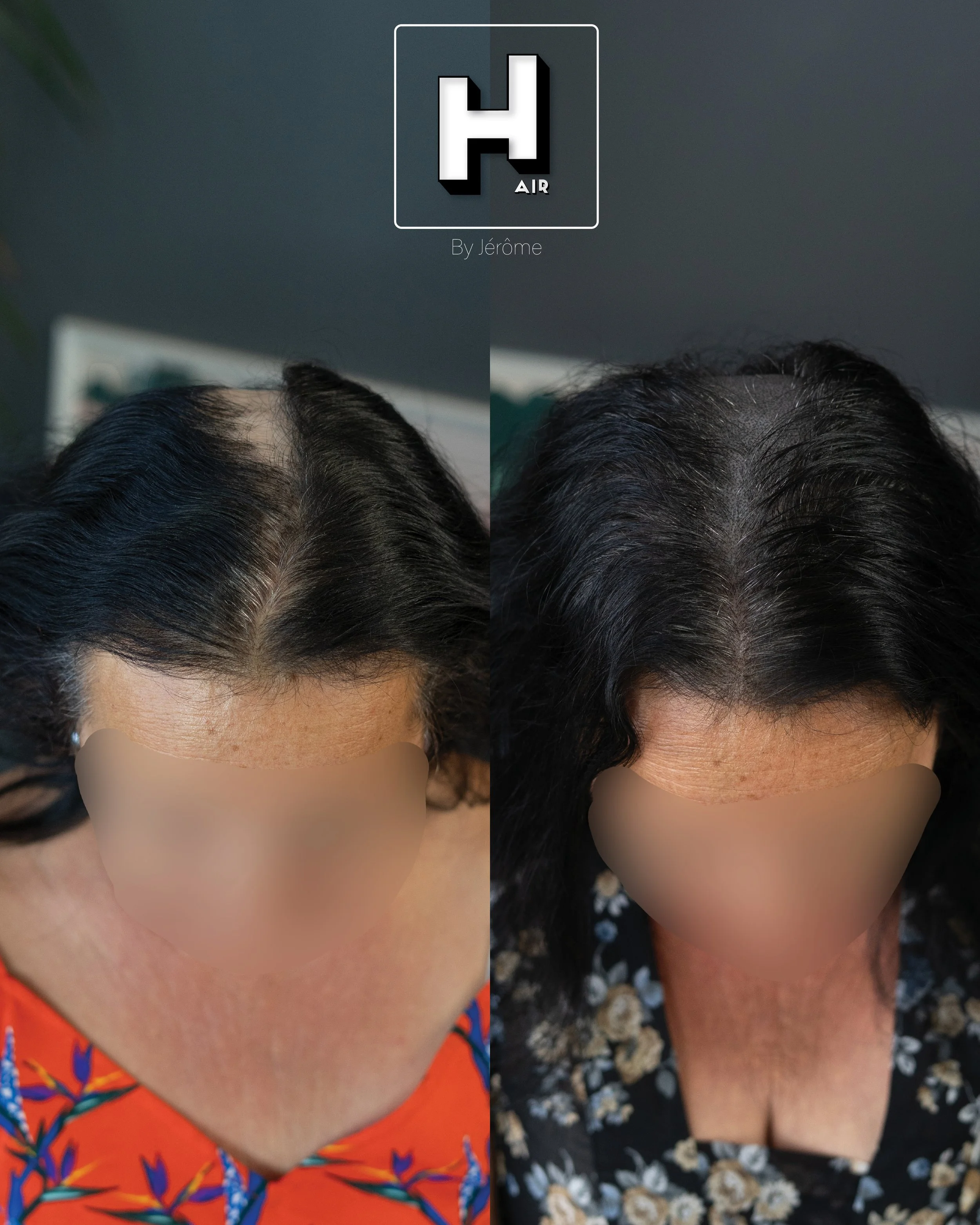 densité extreme femme.jpg