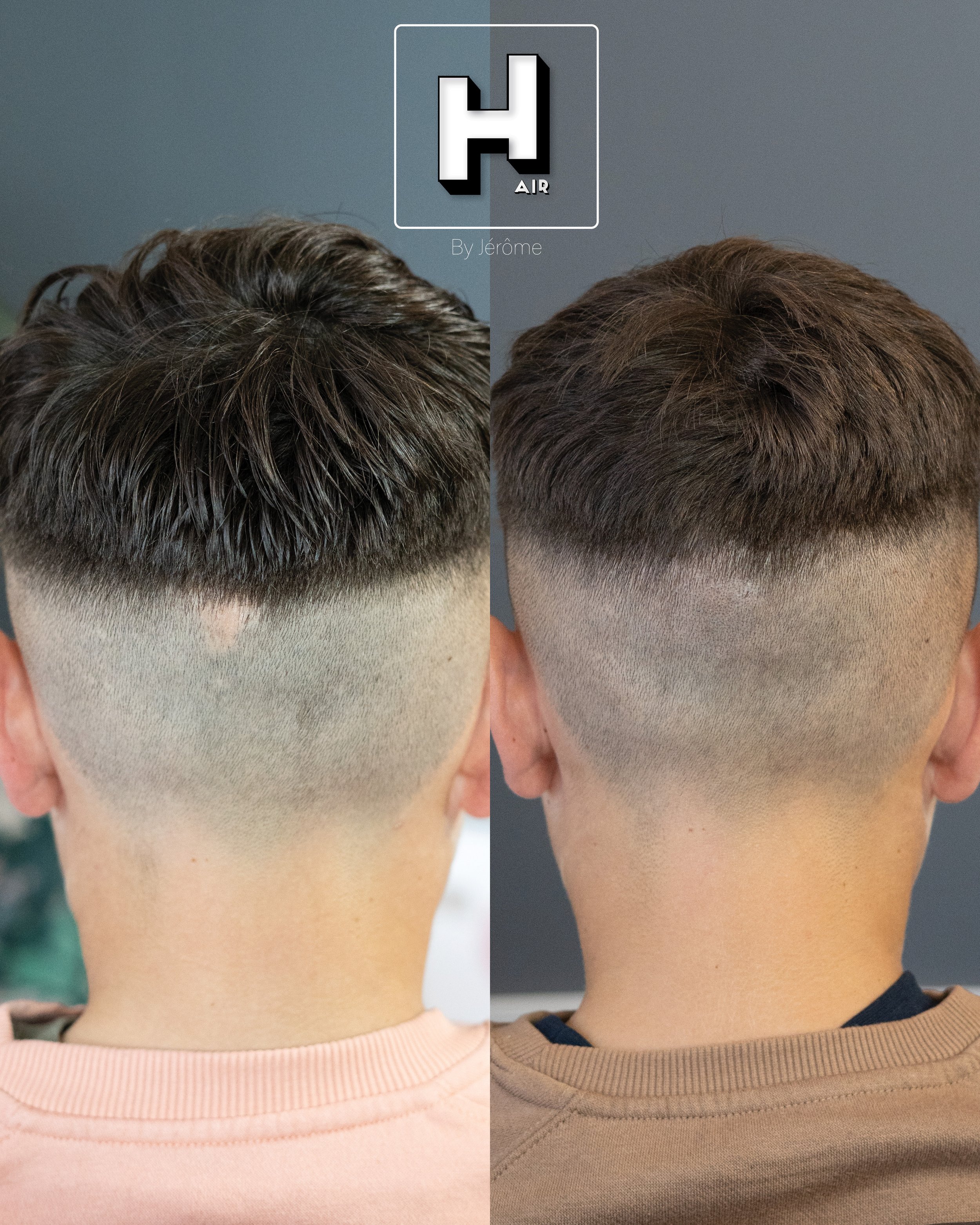 Camouflage cicatrice garcon 13 ans hair by jerome2.jpg