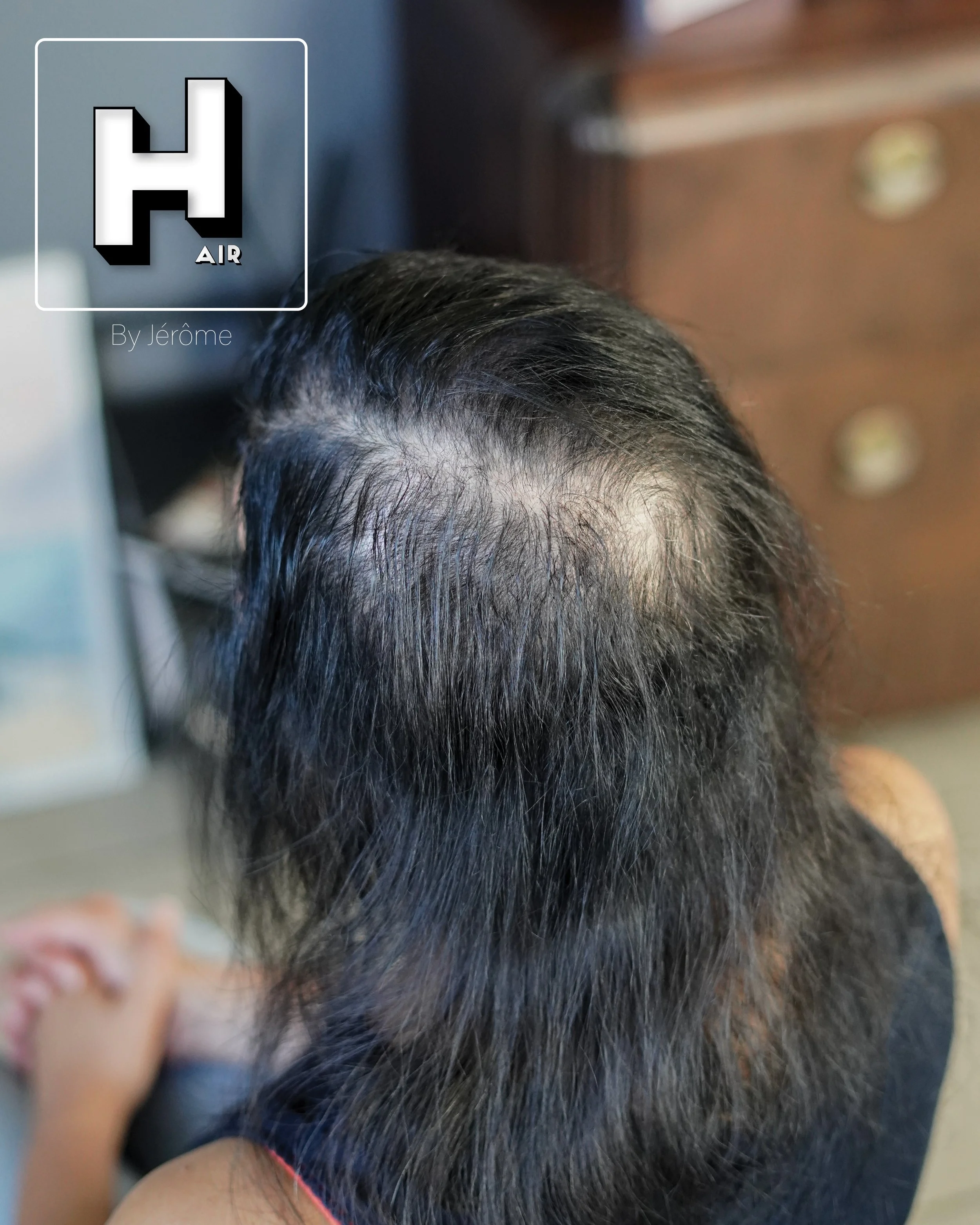 densité hair by jerome smpbelgium smpartistbelgium micropigmentationbelgium4.jpg