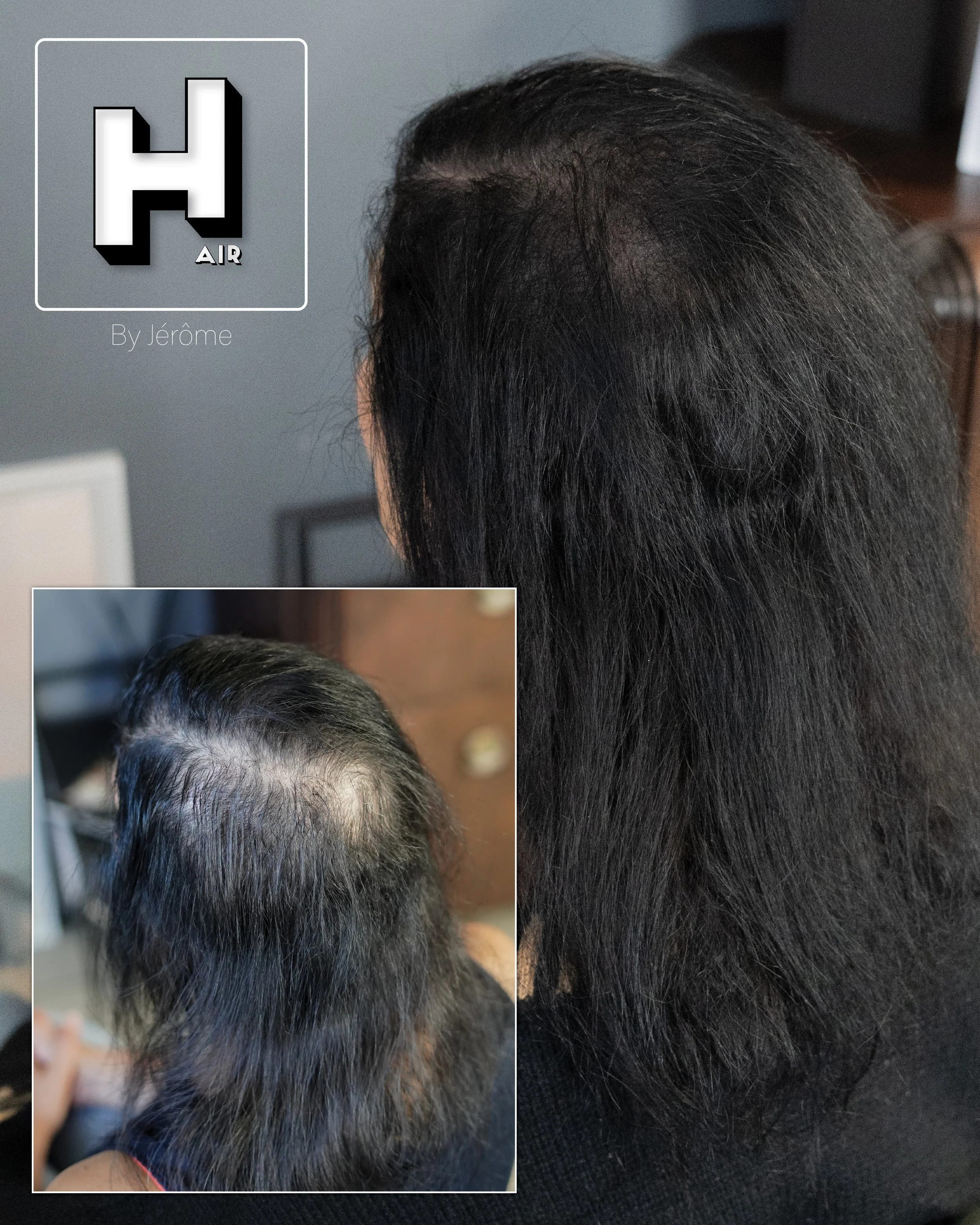 densité hair by jerome smpbelgium smpartistbelgium micropigmentationbelgium3.jpg