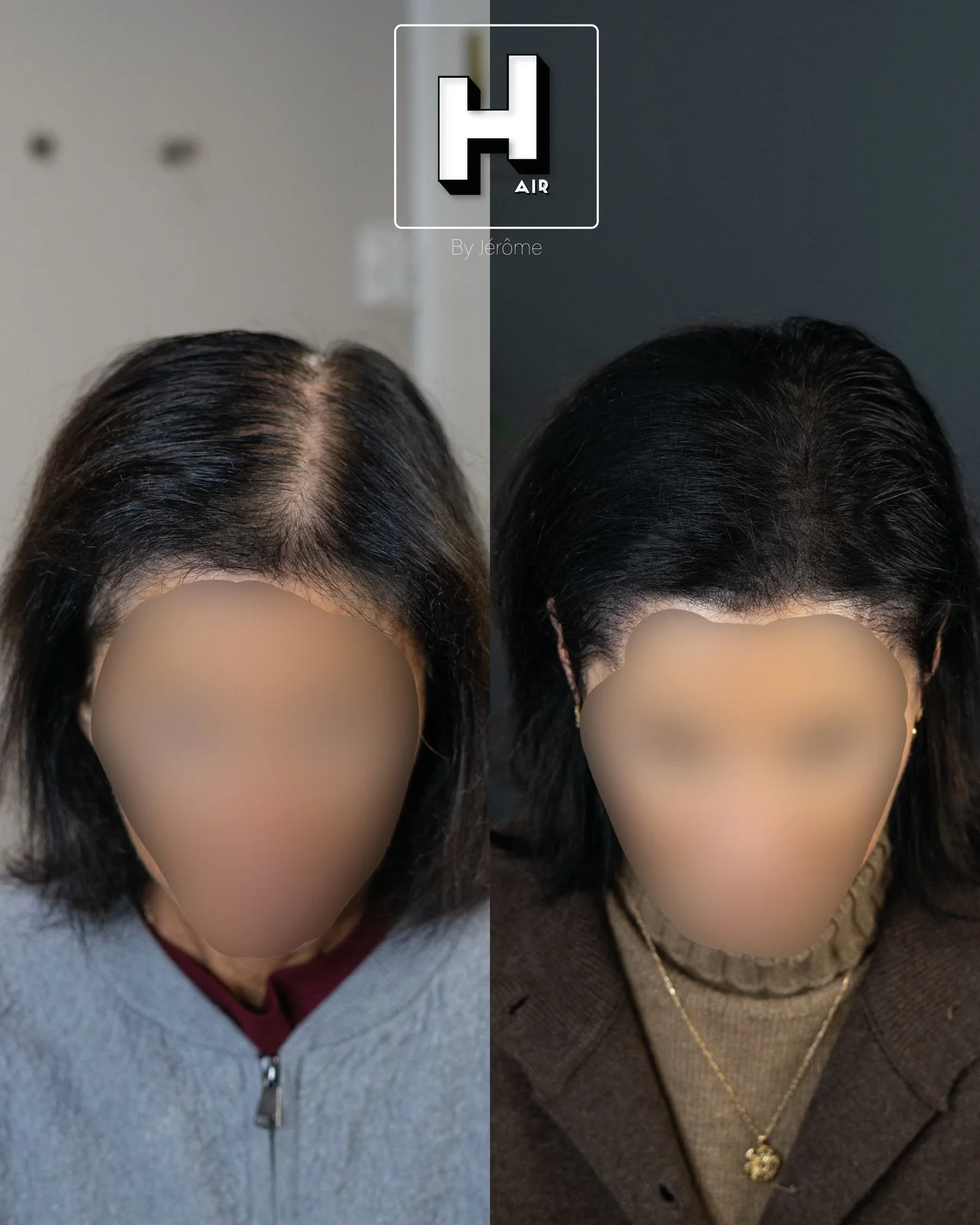 Girl power 💁🏻&zwj;♀️
Fini les complexes, fini la difficult&eacute; &agrave; se coiffer 🙌🏻
Density is the key 🔥
.
Renseignements :
👉🏻 www.hairbyjerome.be
👉🏻 0477 524108
👉🏻hairbyjerome.namur@gmail.com
.
&laquo;&nbsp;99 problems but my hair a