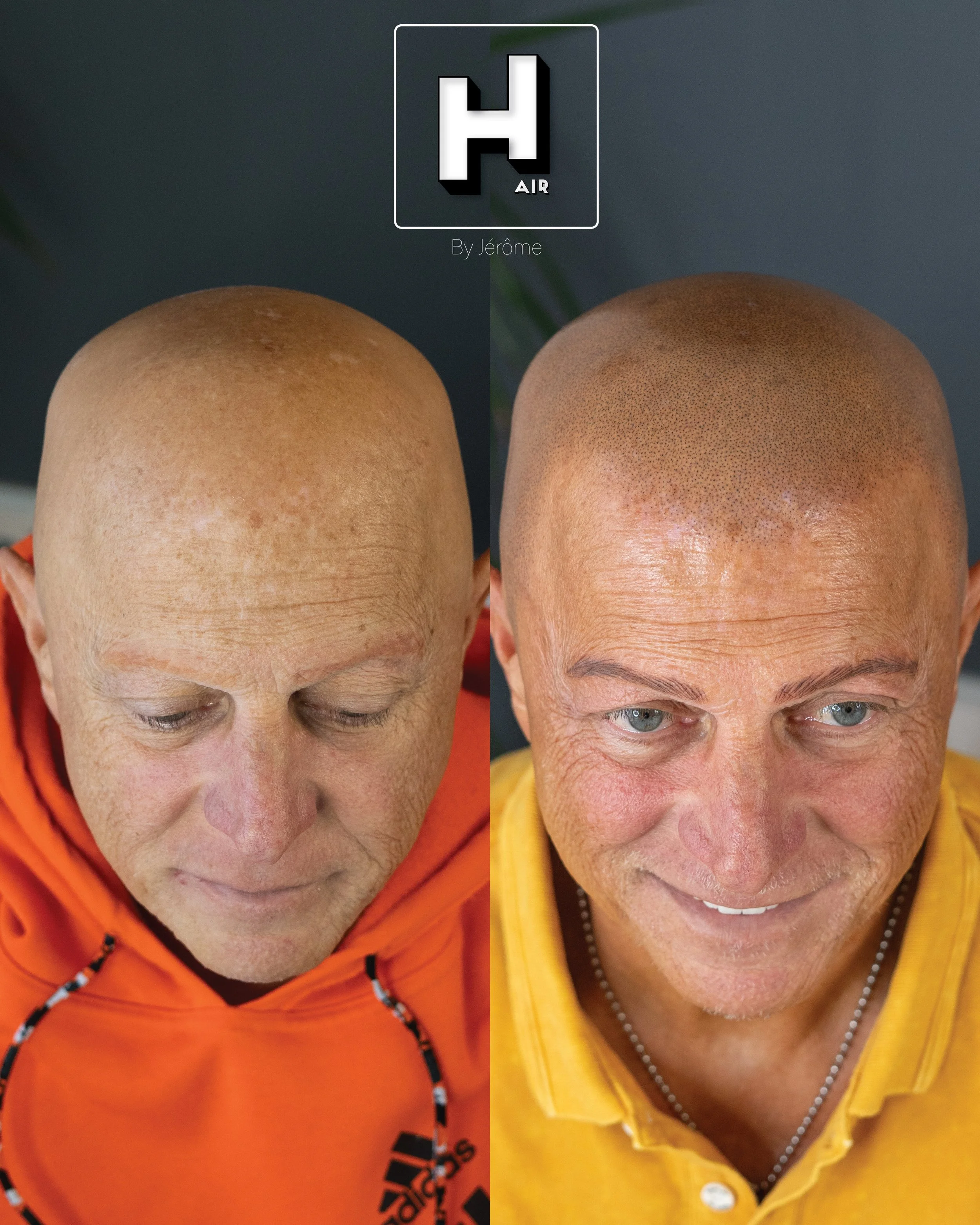alopecie  universelle hair by jerome smp8.jpg