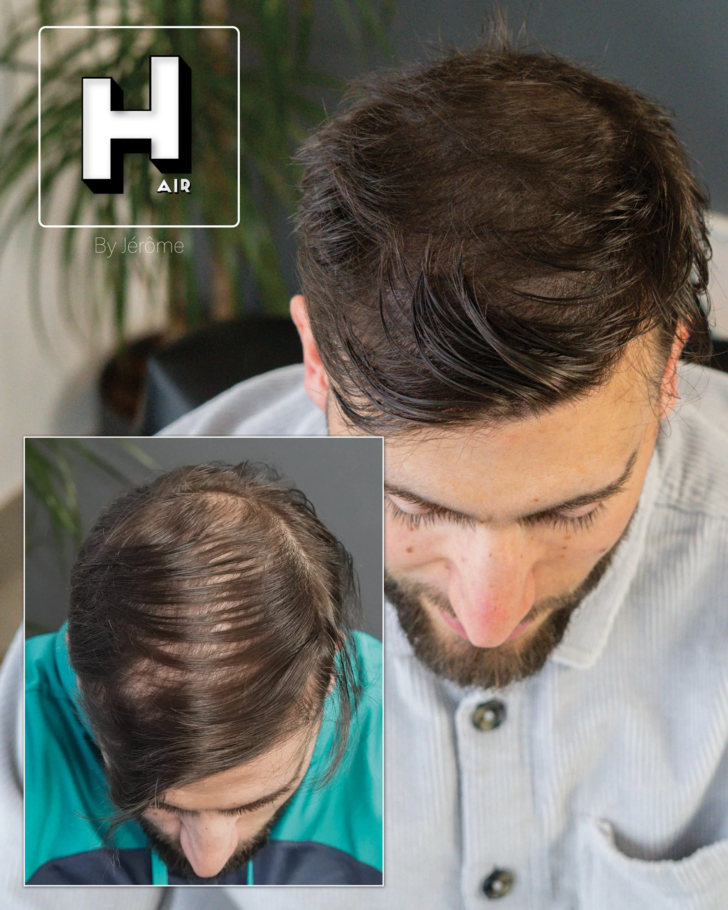 densité  cheveux smp hairbyjerome namur belgique3.jpg
