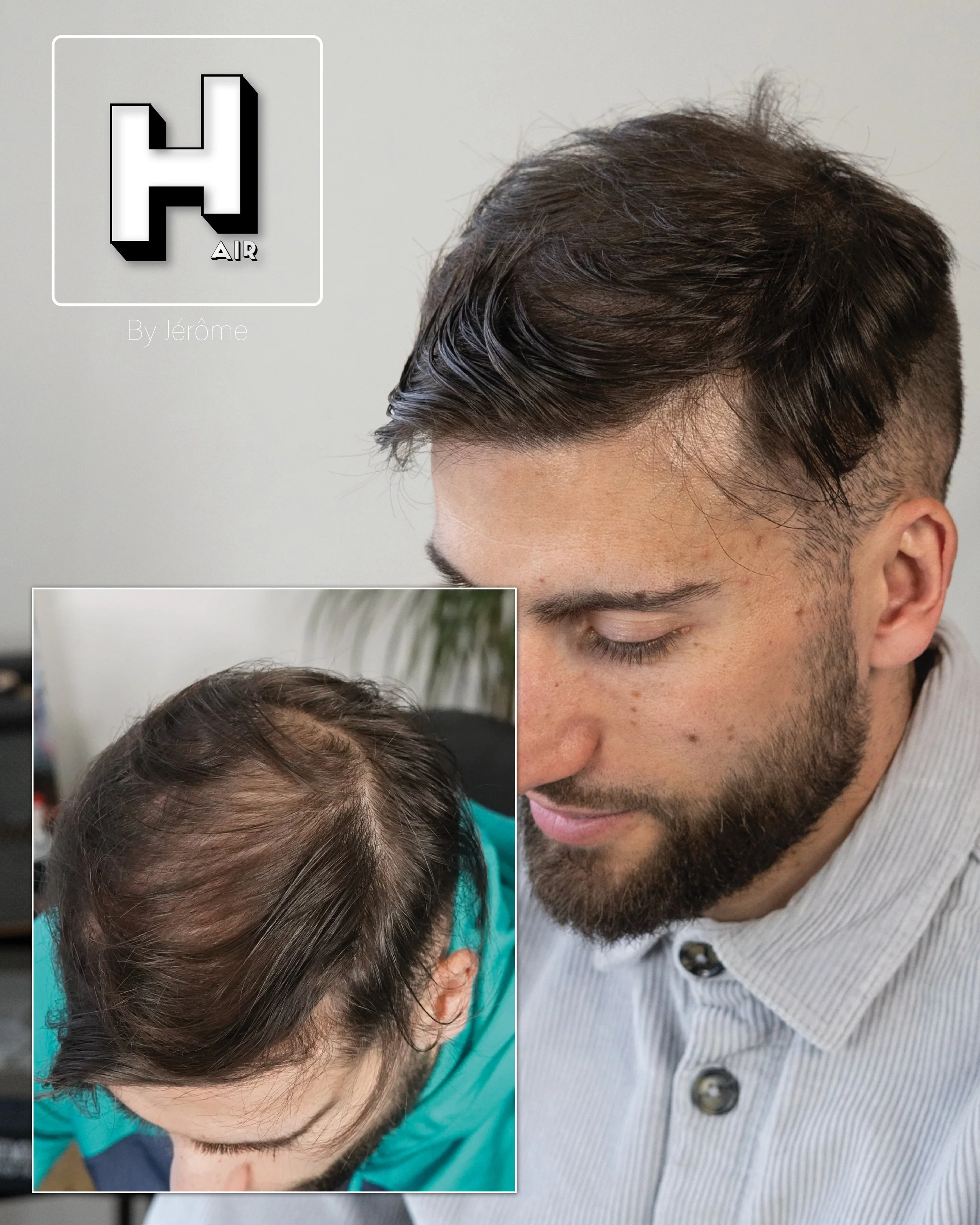 densité  cheveux smp hairbyjerome namur belgique4.jpg