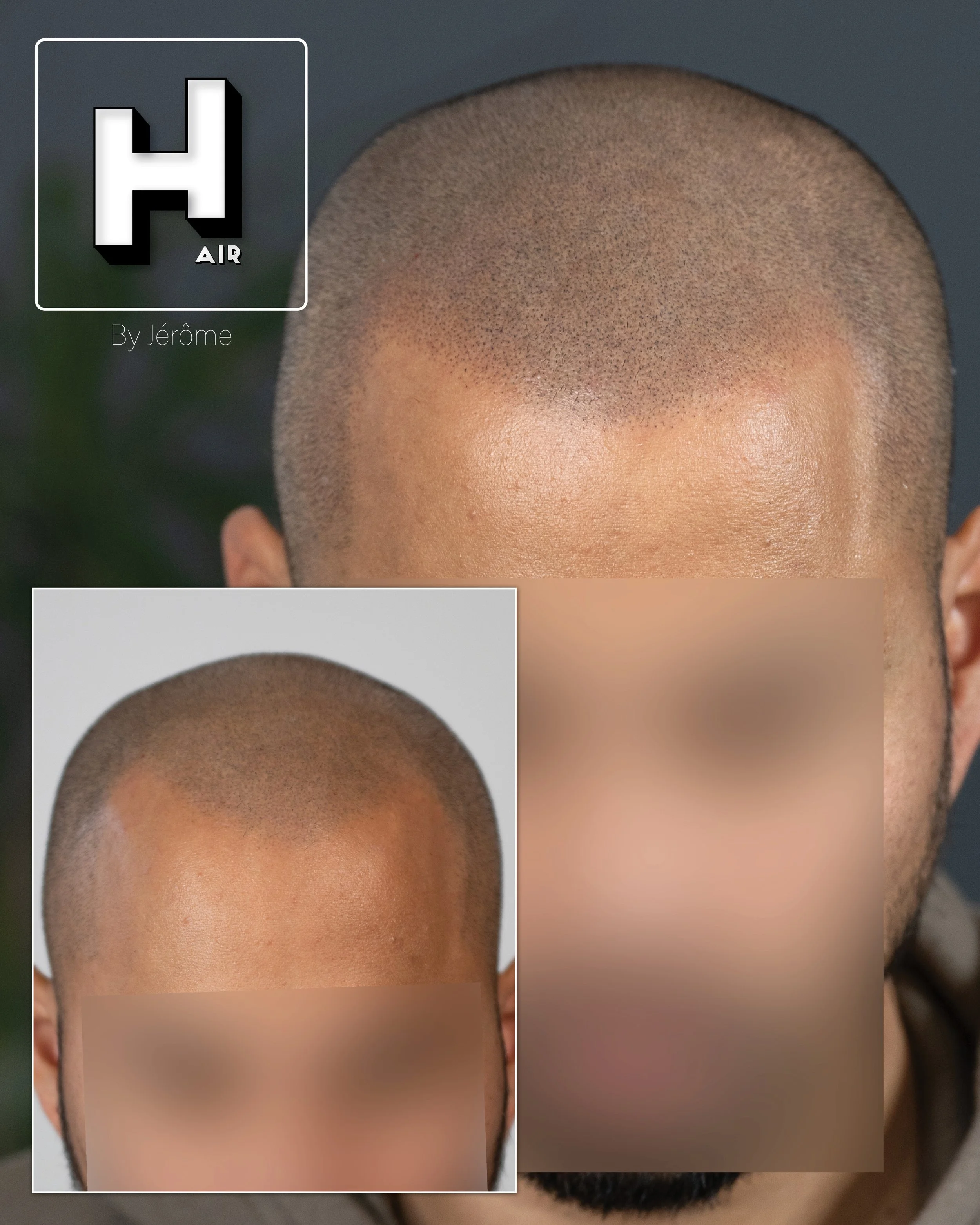 effet rasé ligne frontale hair by jerome smpartistbelgium.jpg