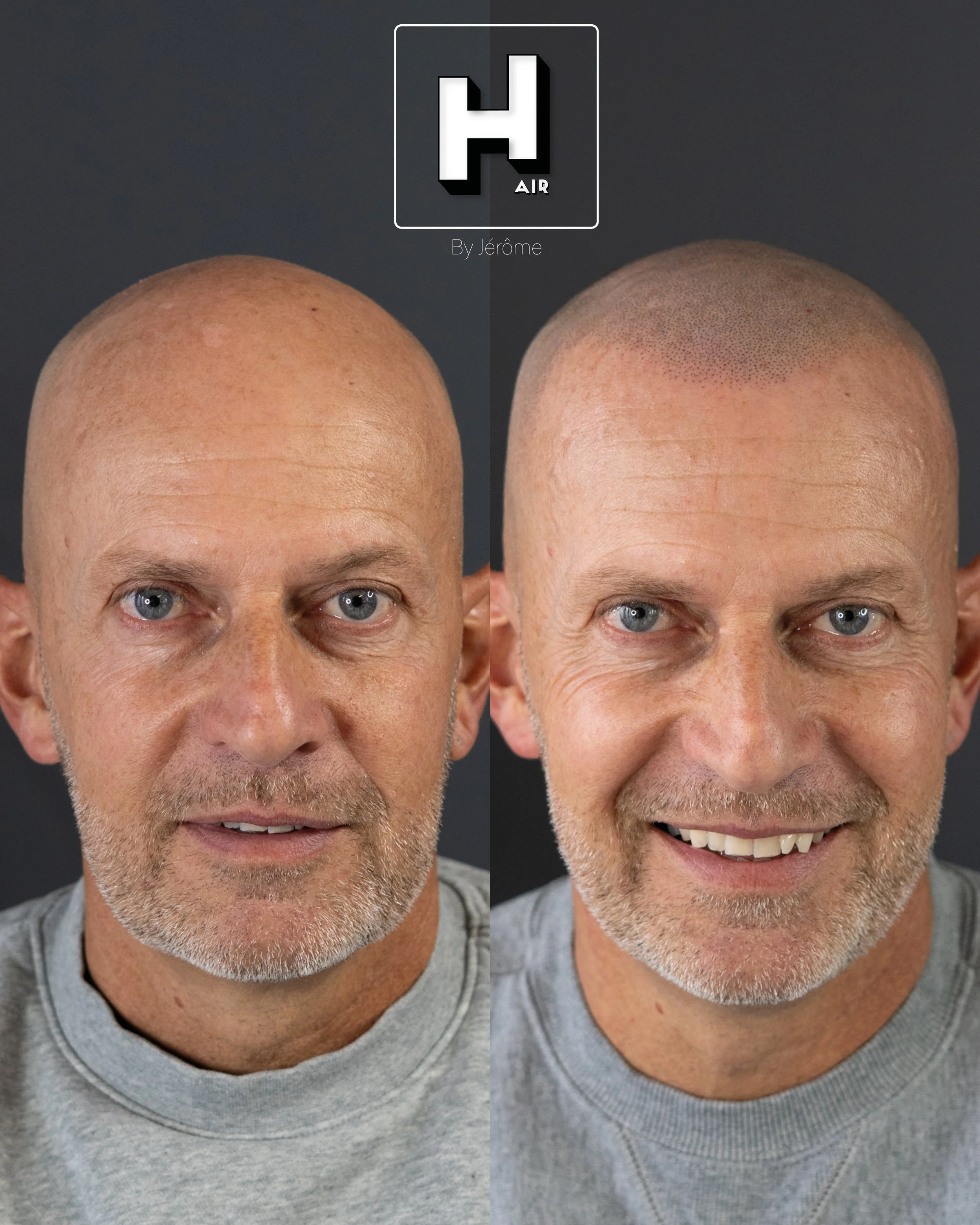 hair byjerome smp namur belgique micropigmentation7.jpg
