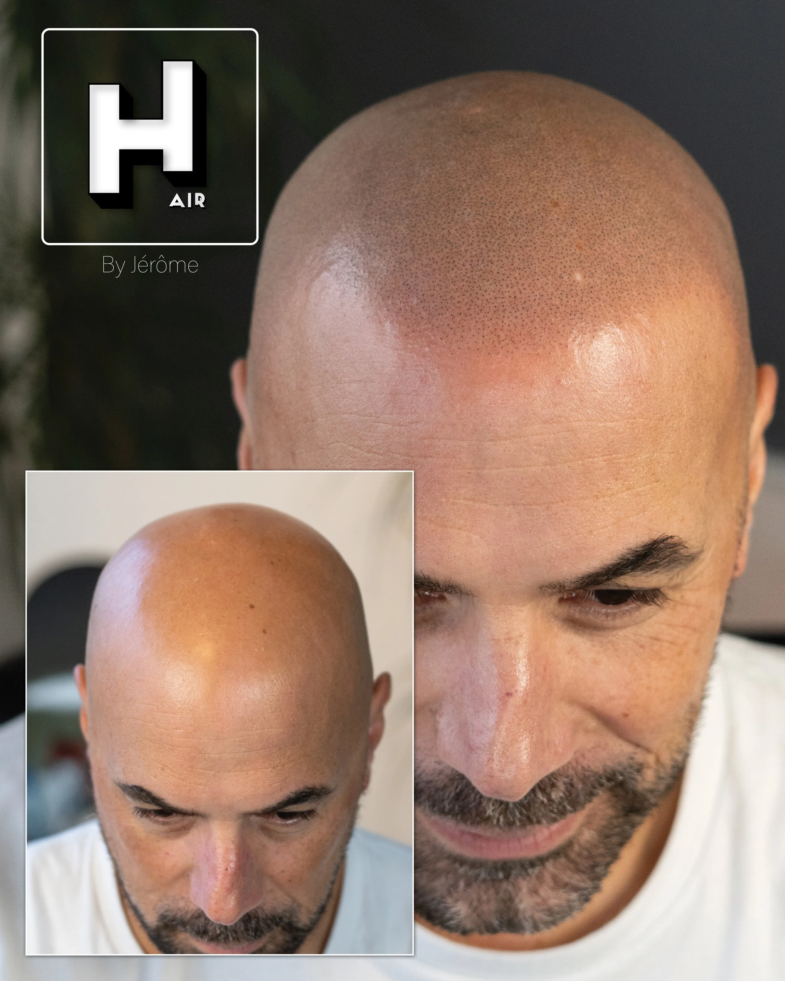natural smp hair by jerome micropigmentation capillaire effet naturel belgique2.jpg