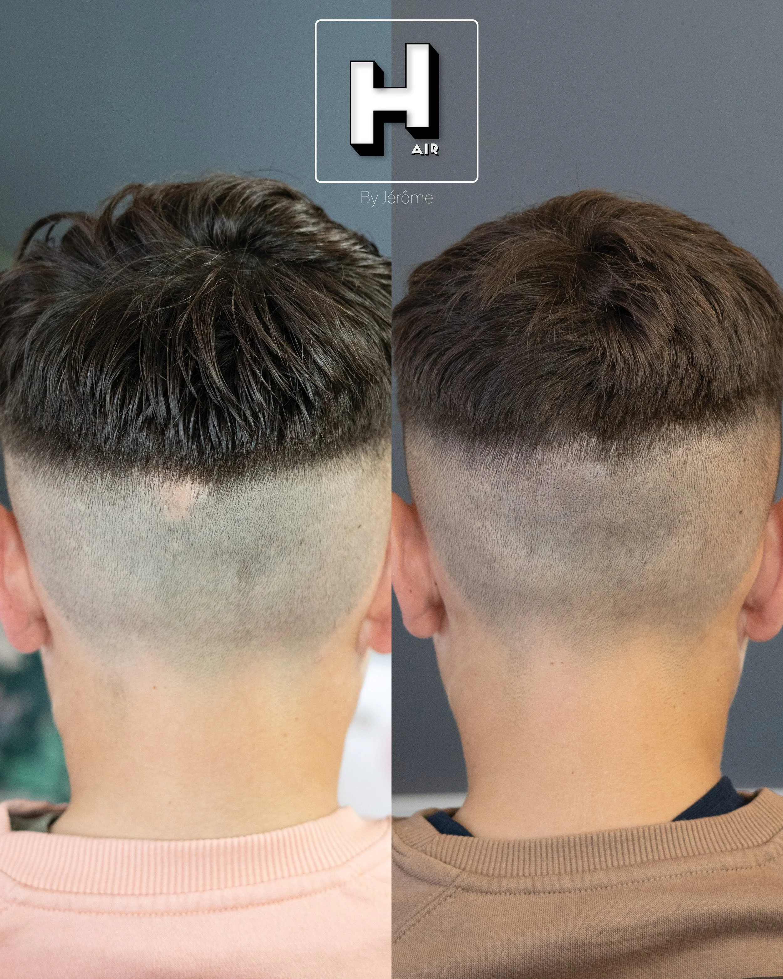Camouflage cicatrice garcon 13 ans hair by jerome2.jpg