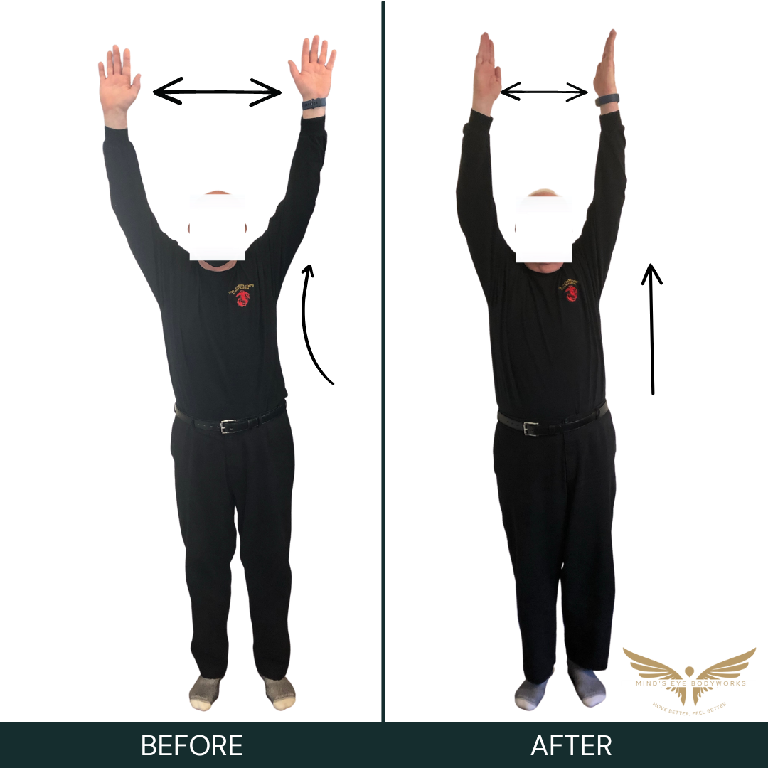 Functional Movement Transformation Improve Posture Decrease Pain Fast.png