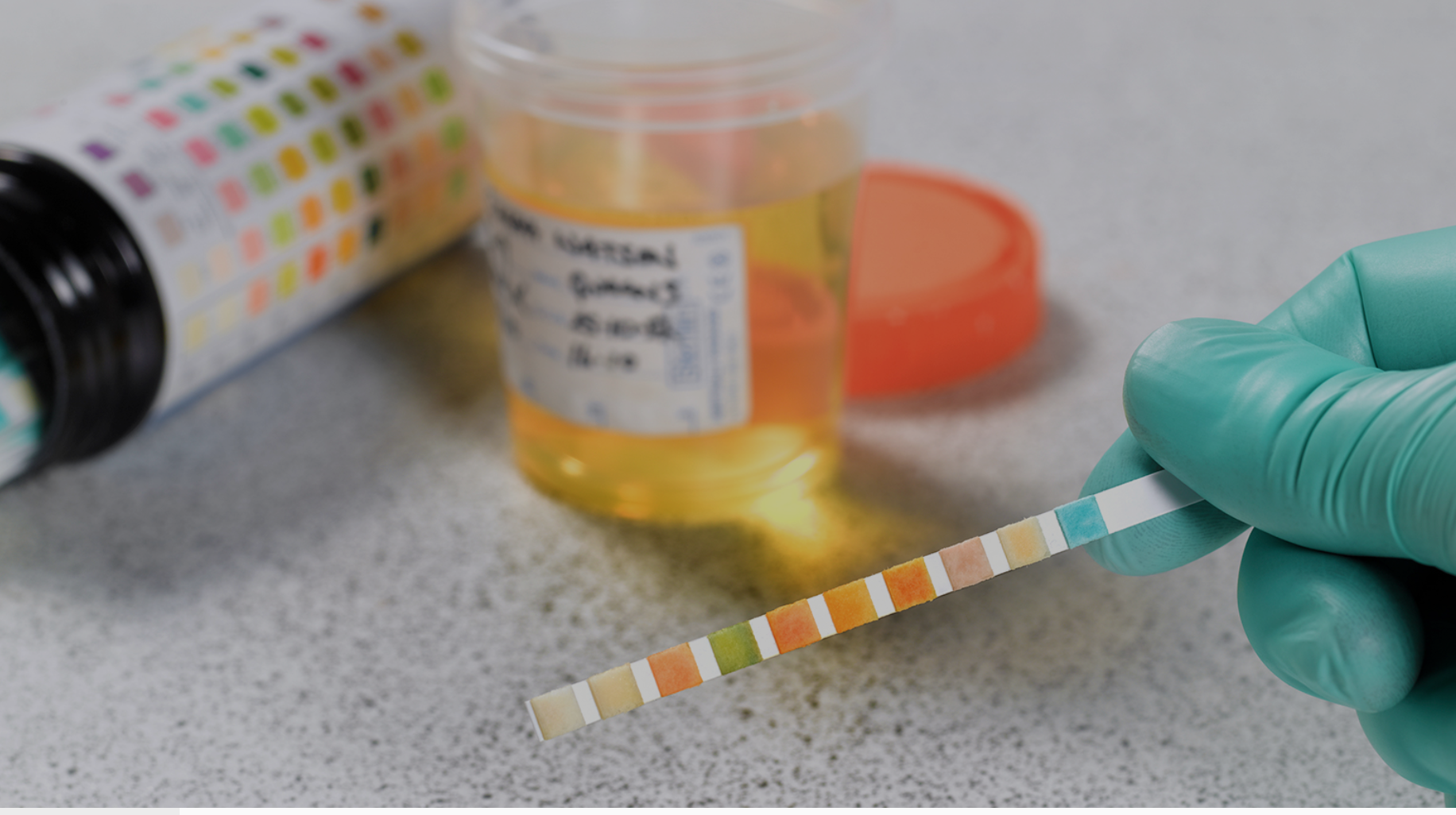 Drug Testing: An Essential Tool in Recovery