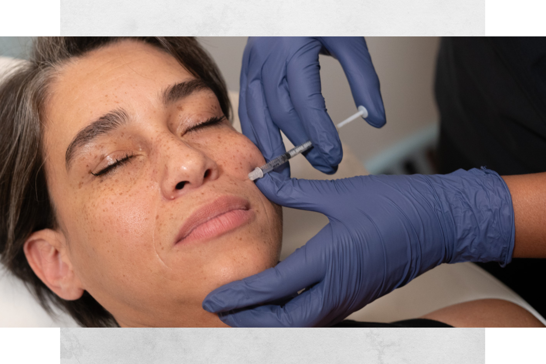 A woman receiving a cosmetic injection in her cheek while lying with eyes closed, with a person wearing blue gloves administering the shot.