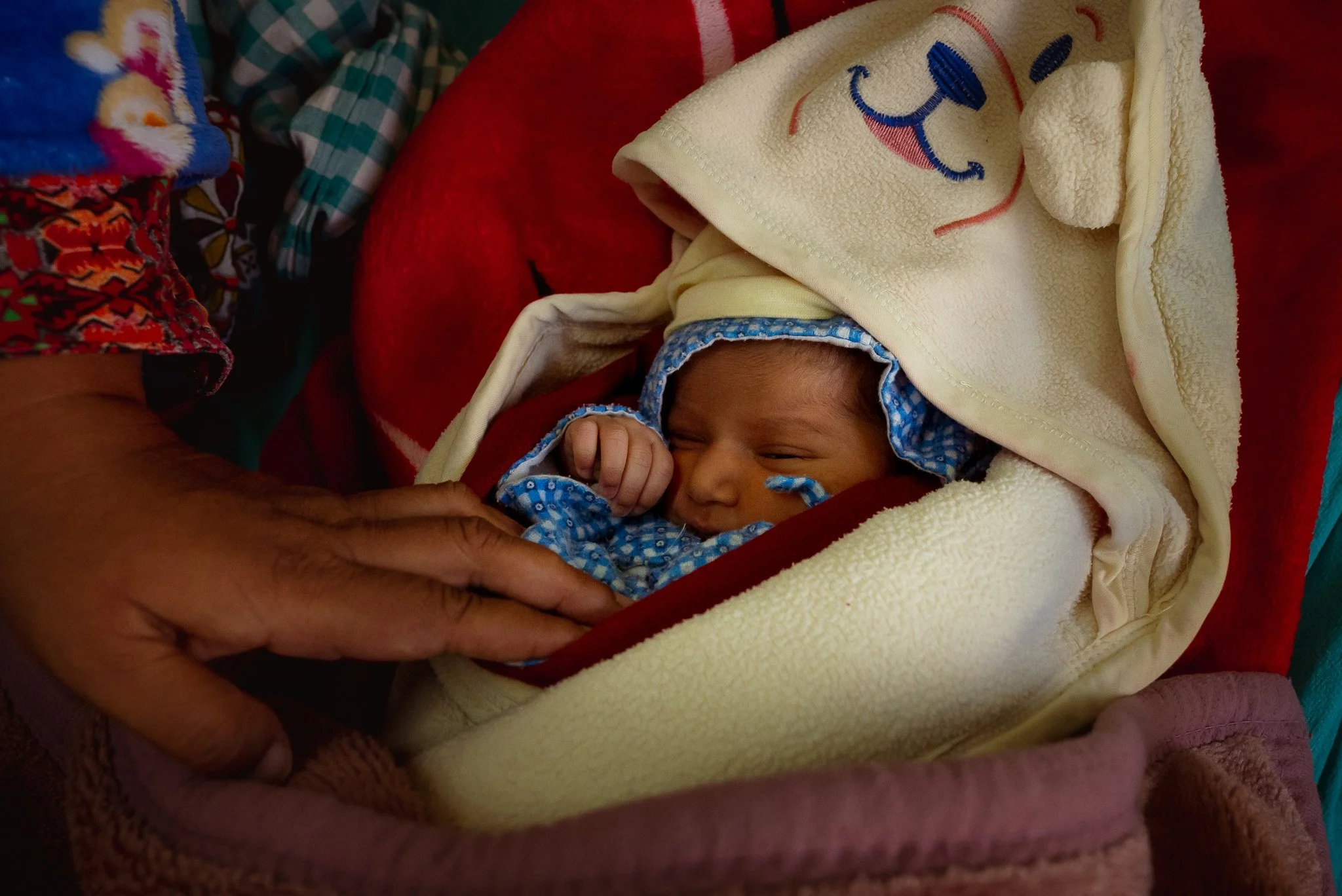 A child born to a woman who later developed obsetric fistula in the Obstetrics and Gynaecology department at the Social Services Hospital Kathmandu.