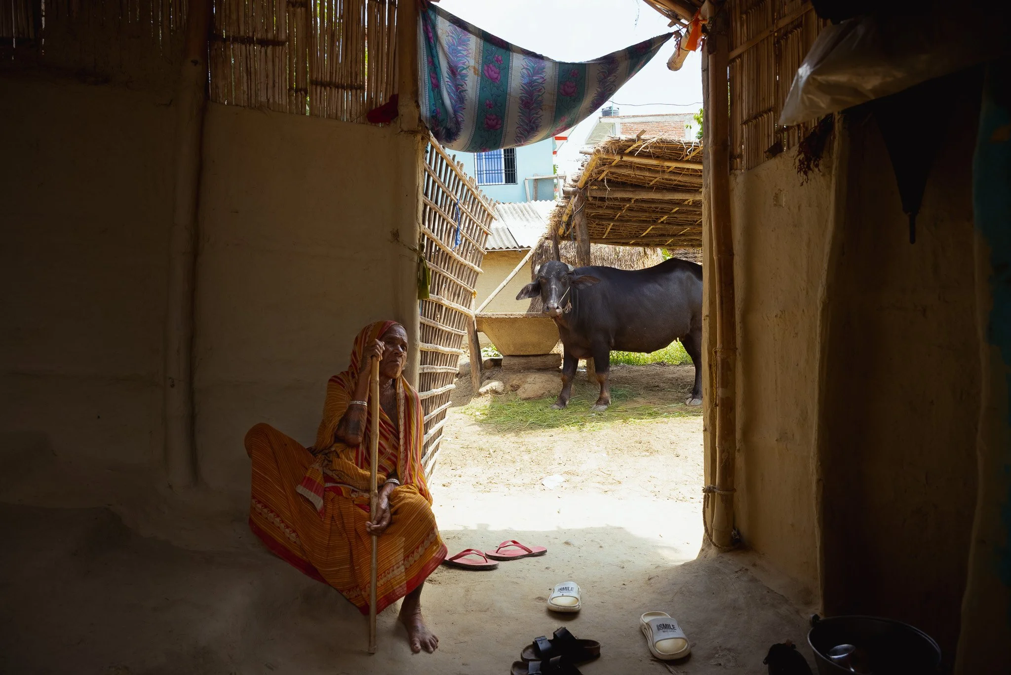 Fistula tends to affect some of the poorest populations in Nepal.