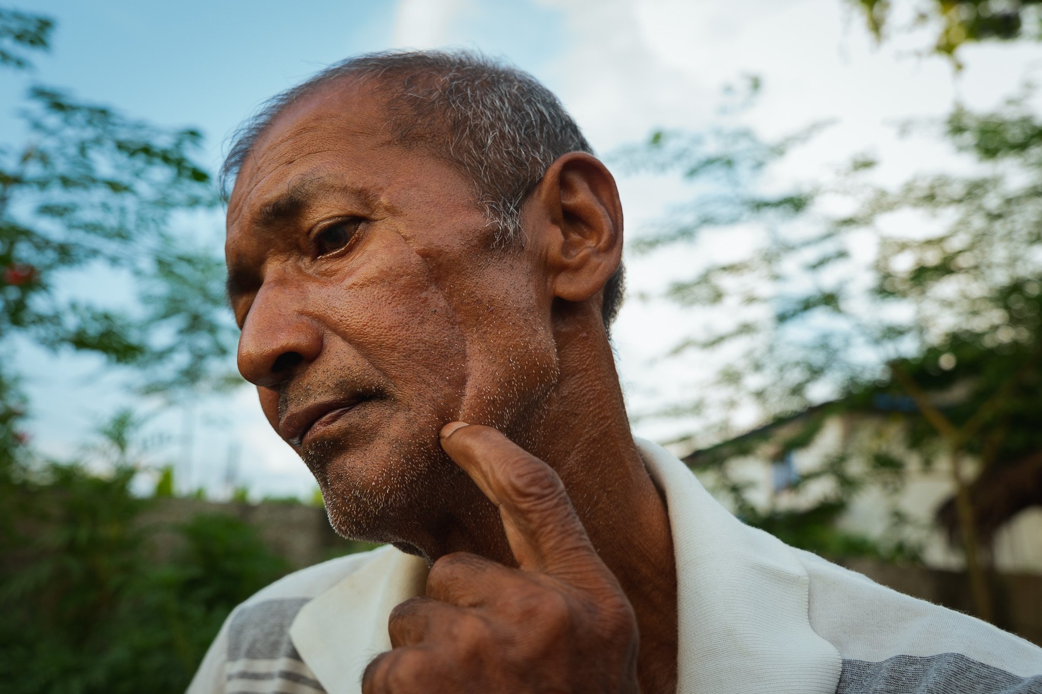 Lilarag Kumal, 61, shows the facial scar sustained from a tiger attack, shot for The Telegraph (Chitwan, Nepal)