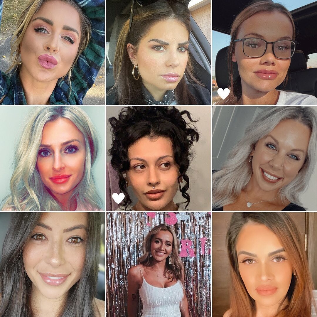 What would we be without 𝙔𝙊𝙐 🤩
⠀⠀⠀⠀⠀⠀⠀⠀⠀
When was the first time you visited us? Comment 👇🏼💉🤍💋✨
⠀⠀⠀⠀⠀⠀⠀⠀⠀
We love our #PortoCosmeticSurgery fam! 🫶🏼 Tag us in your selfies to be featured next time.
⠀⠀⠀⠀⠀⠀⠀⠀⠀
#drporto #portopout #injections 