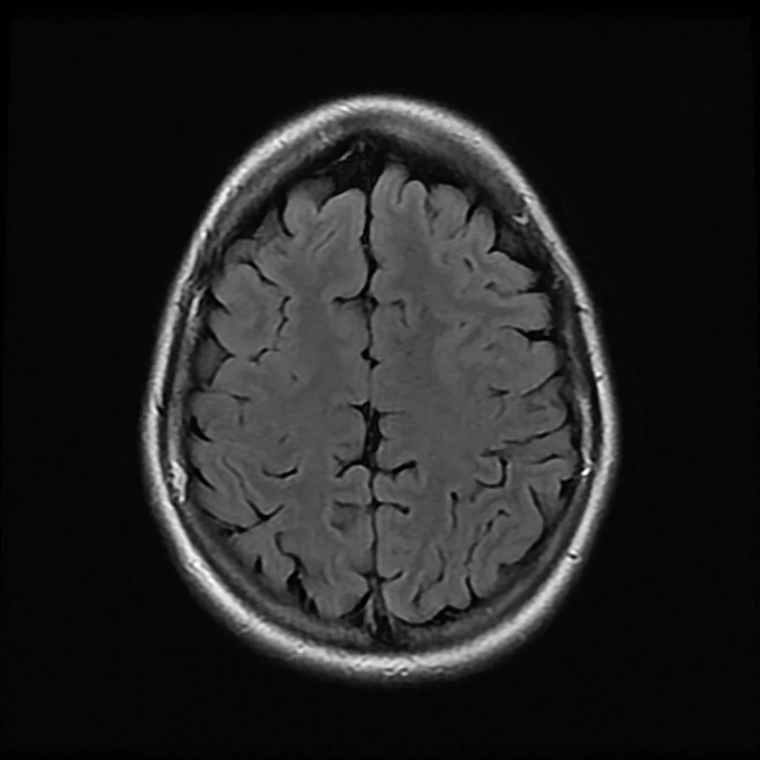 my big, fat, juicy brain