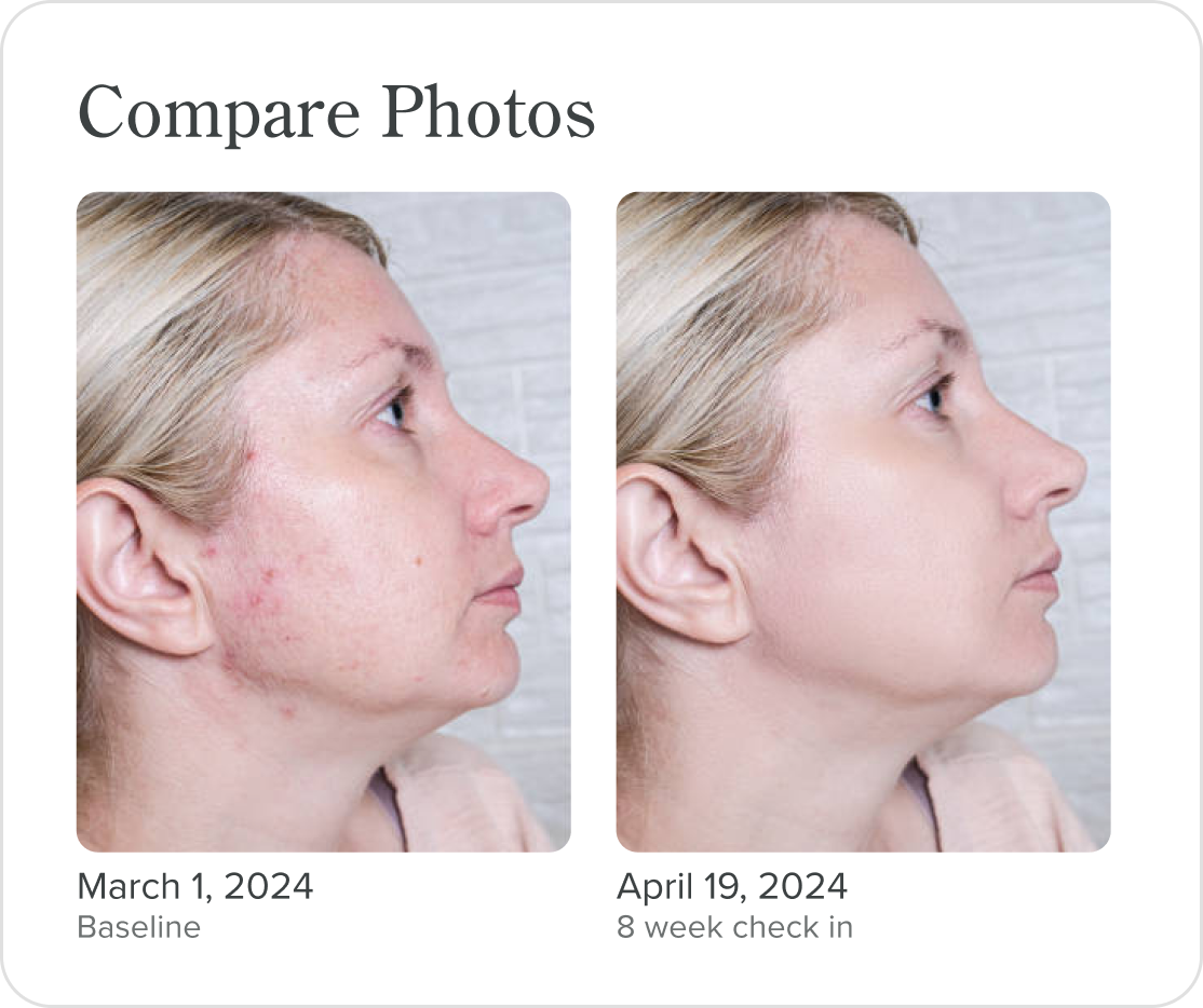 Compare progress photos