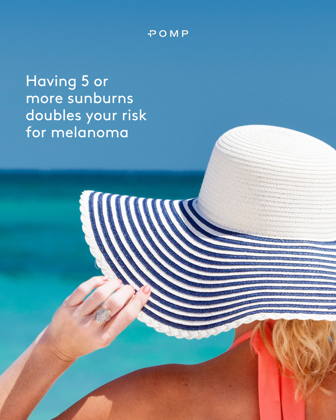 5 or more sunburns.png
